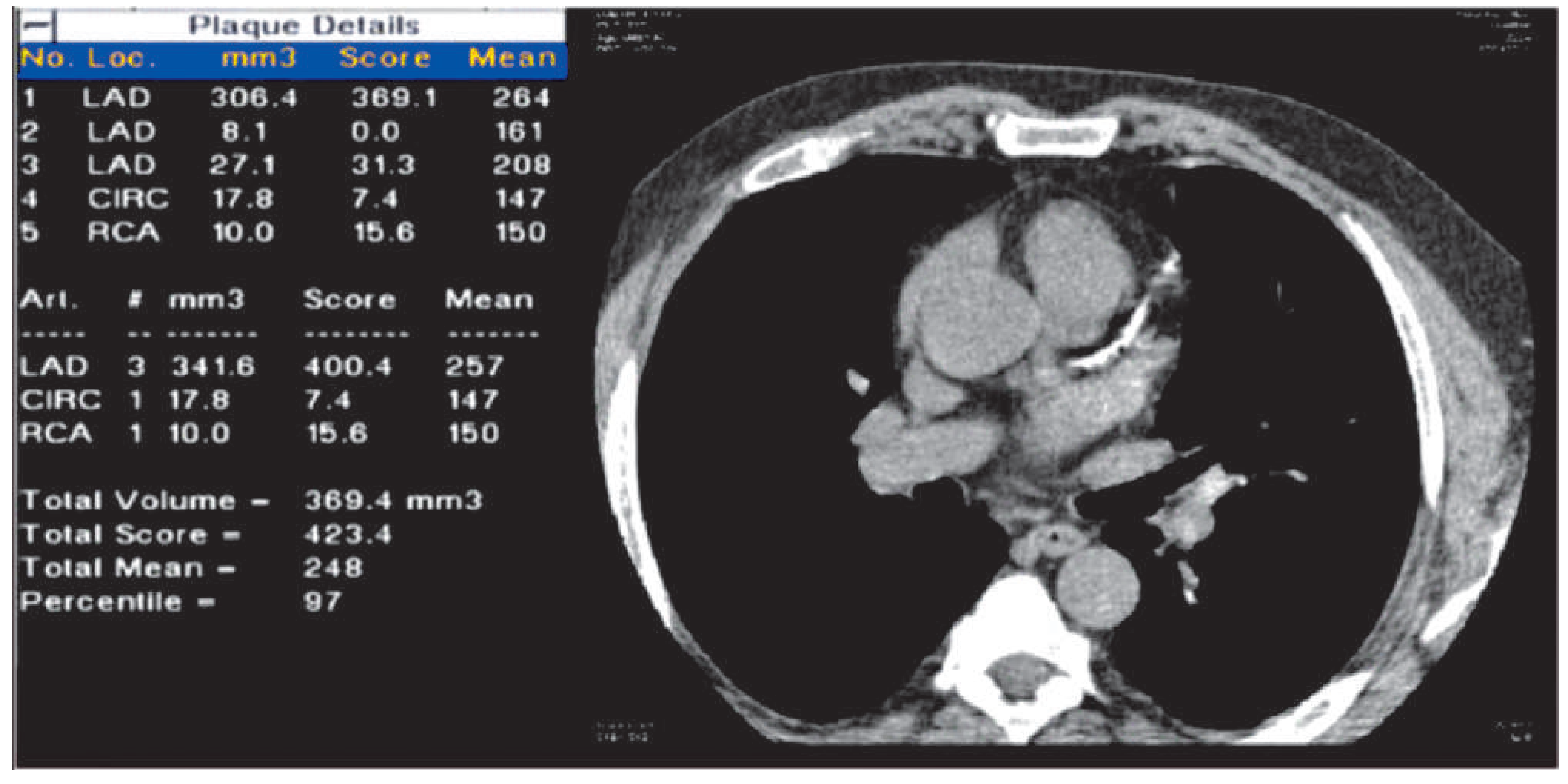 Cardiovascmed 16 00144 g001 Cardiovascmed 16 00144 g001