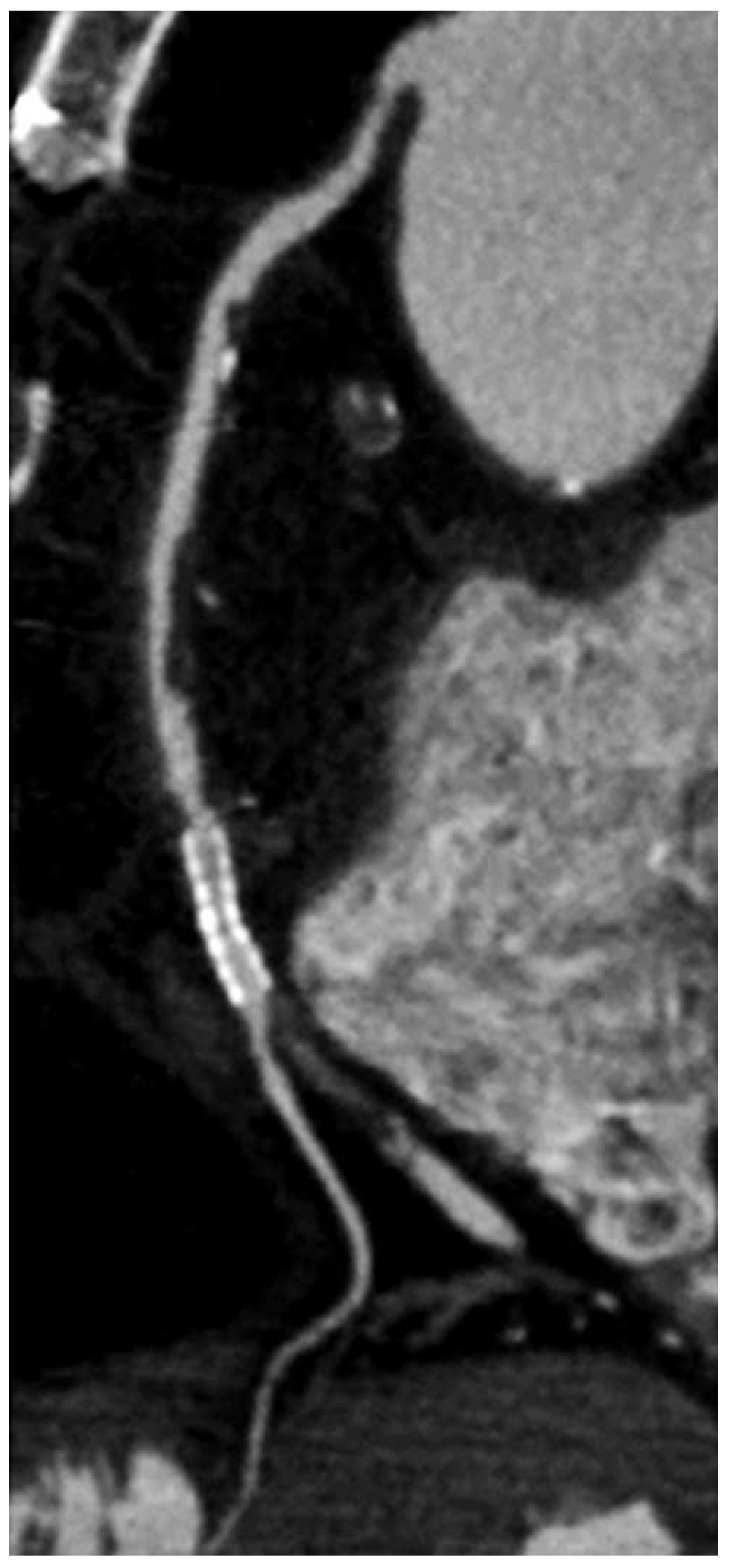 Cardiovascmed 16 00144 g002 Cardiovascmed 16 00144 g002