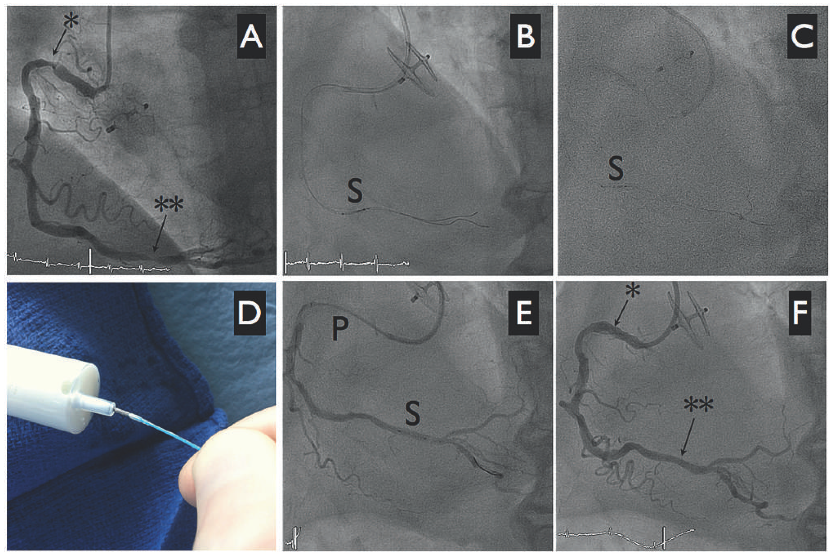 Cardiovascmed 16 00153 g001