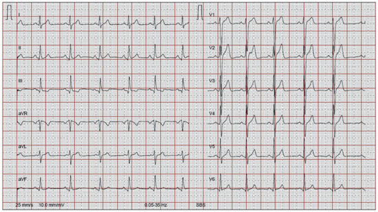 Cardiovascmed 16 00216 g002