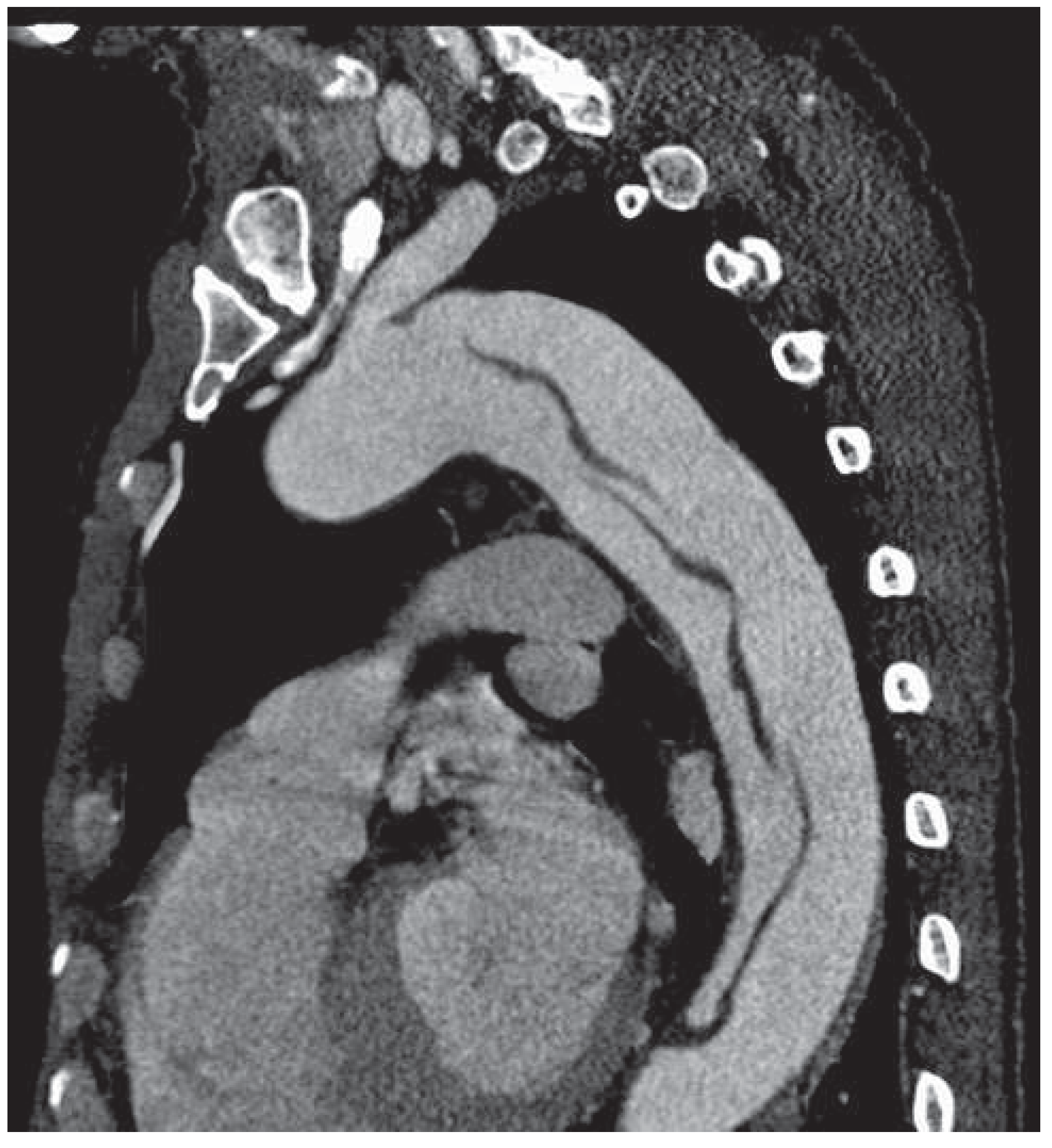 Cardiovascmed 16 00267 g001