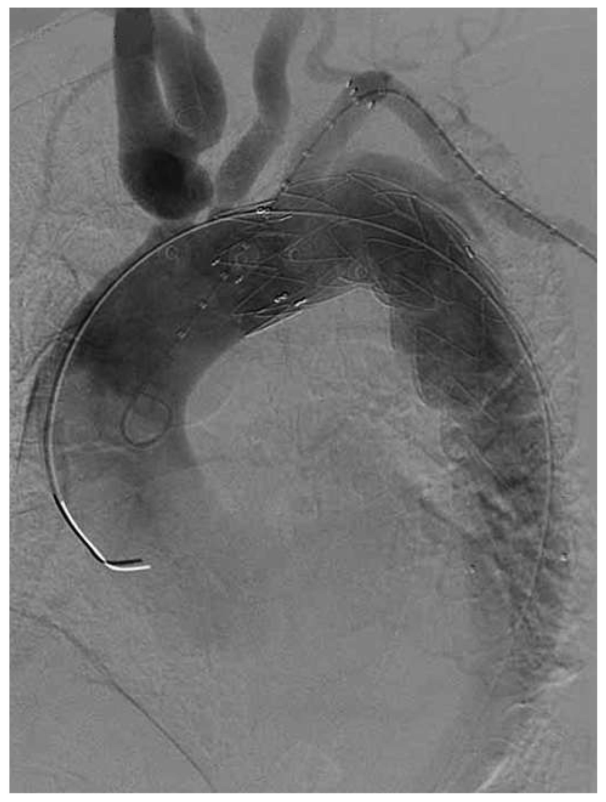 Cardiovascmed 16 00267 g004