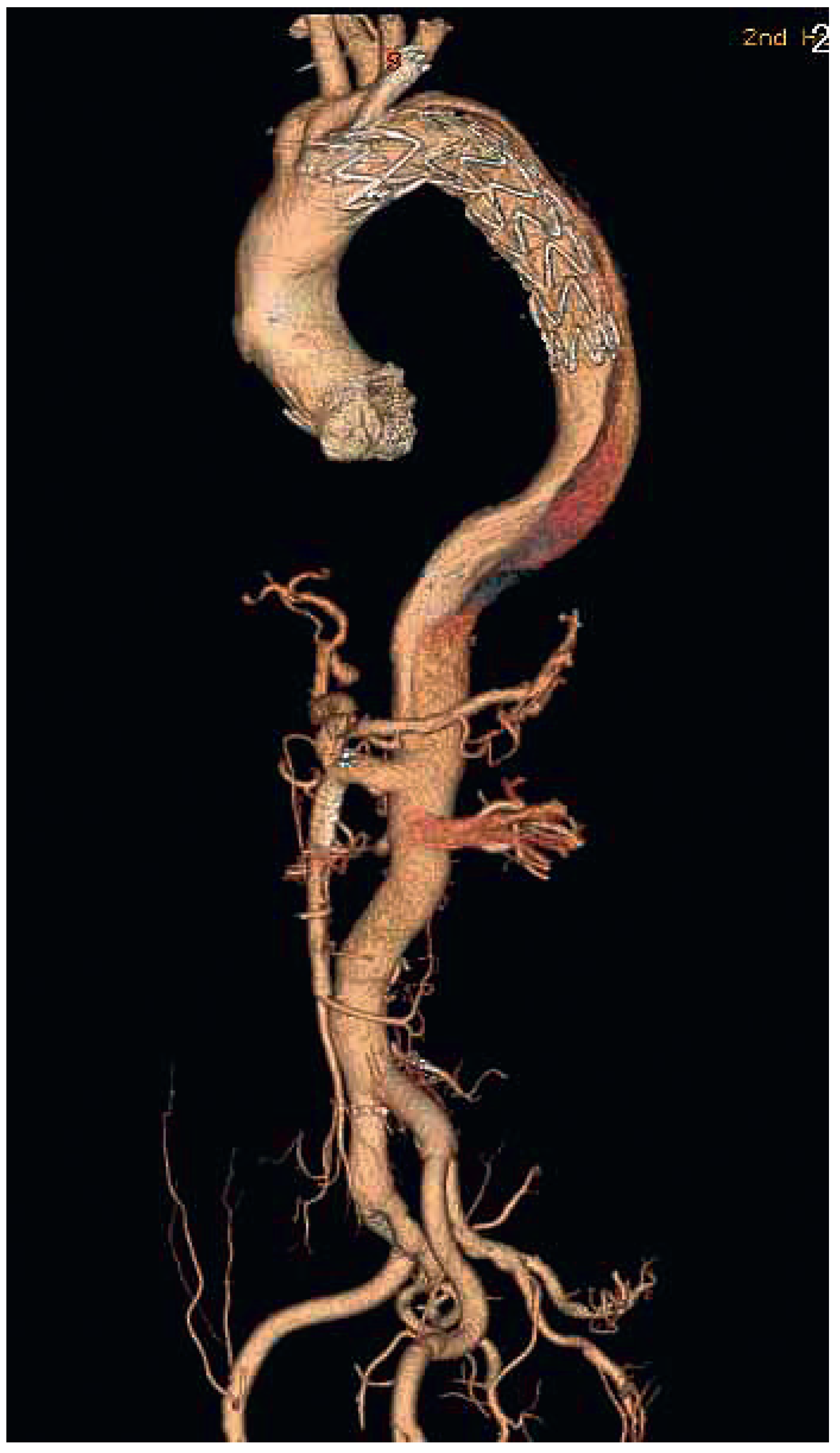 Cardiovascmed 16 00267 g006