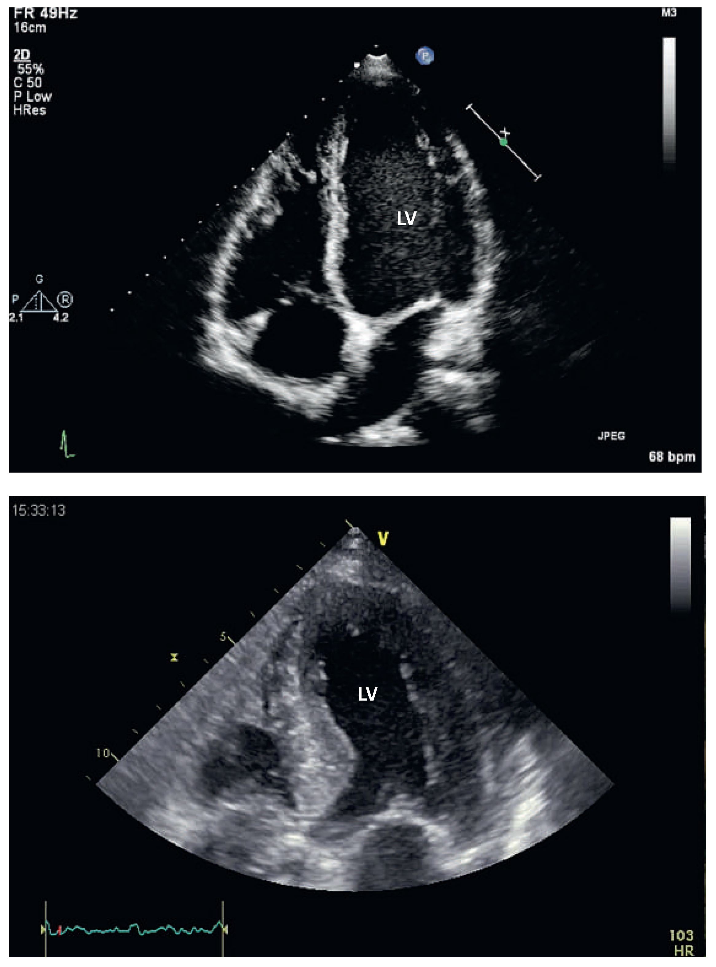 Cardiovascmed 17 00040 g001 Cardiovascmed 17 00040 g001