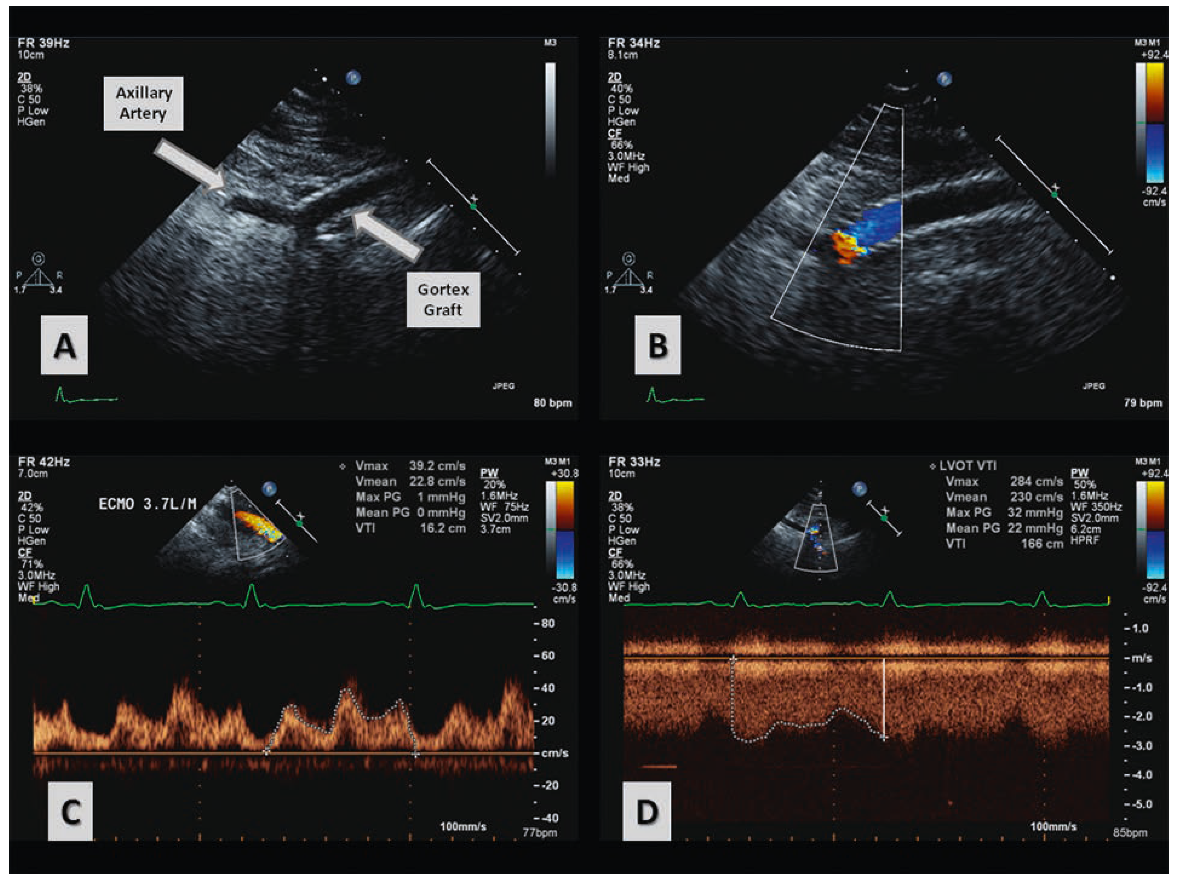 Cardiovascmed 17 00048 g001