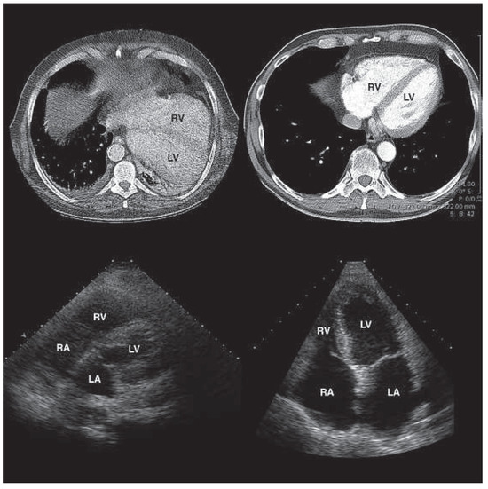 Cardiovascmed 17 00055 g001