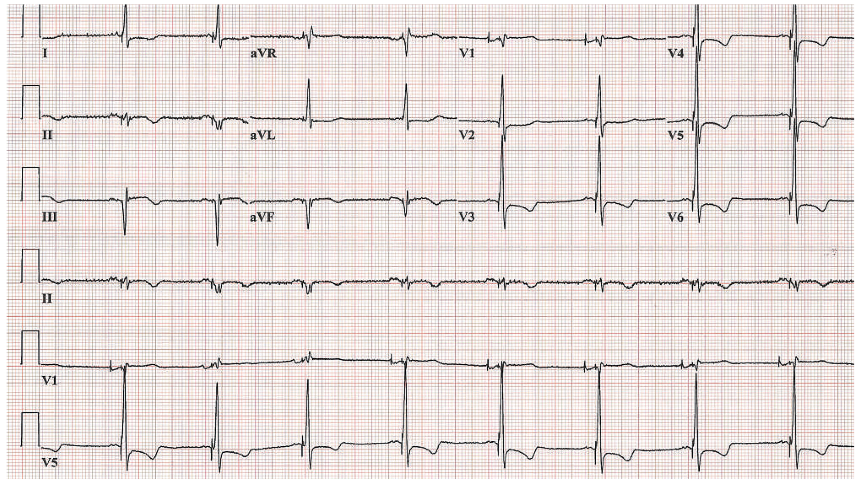 Cardiovascmed 17 00088 g003
