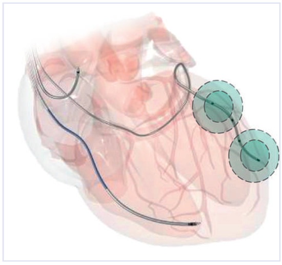 Cardiovascmed 17 00091 g001