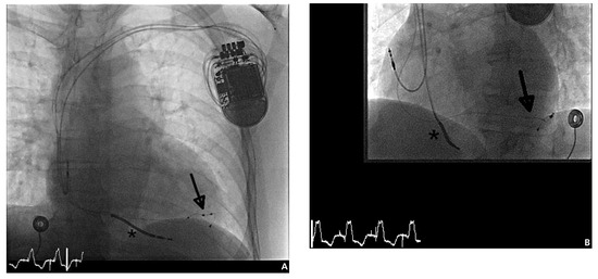Cardiovascmed 17 00091 g002