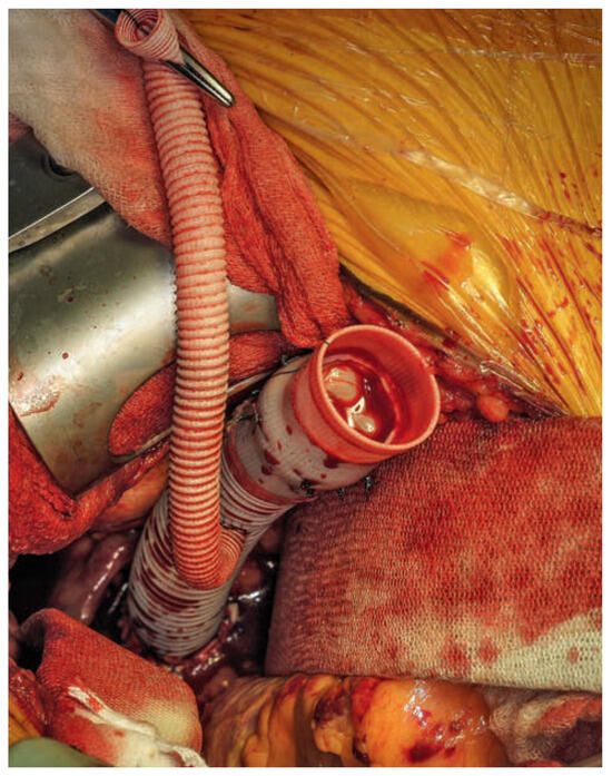 Cardiovascmed 17 00143 g001