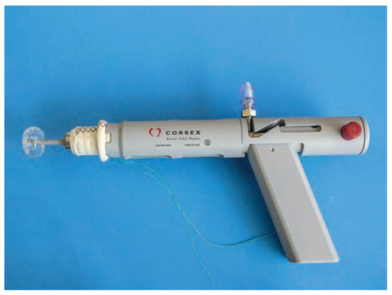 Cardiovascmed 17 00143 g002