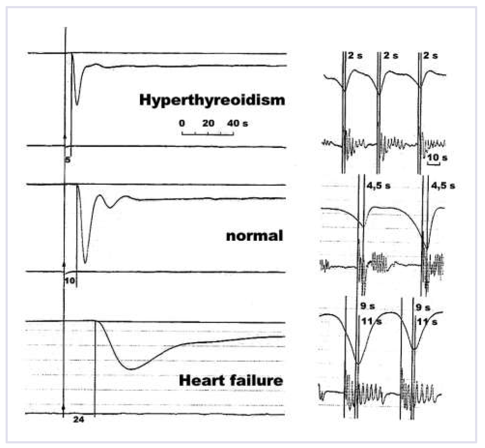Cardiovascmed 17 00256 g002 Cardiovascmed 17 00256 g002