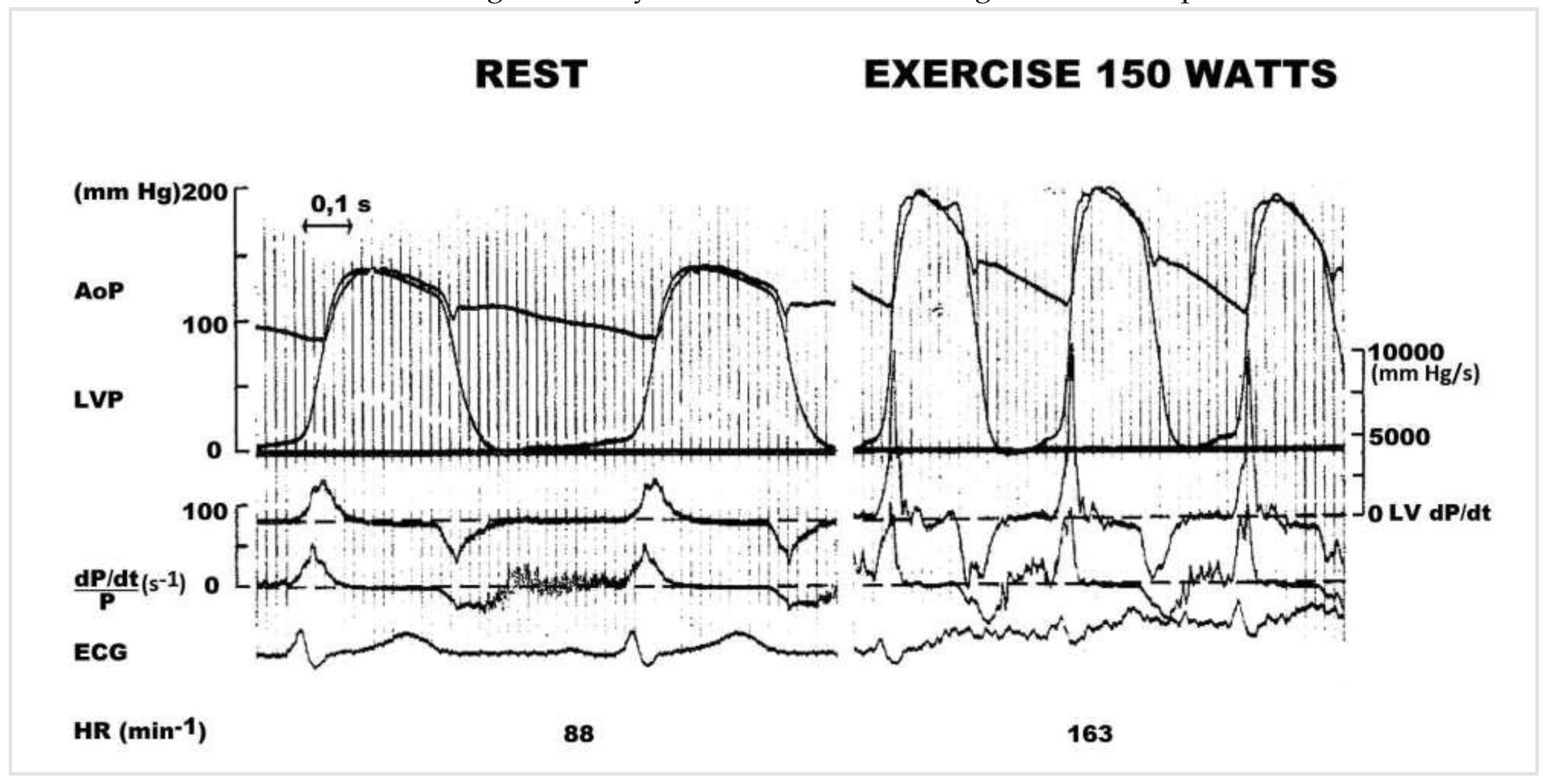 Cardiovascmed 17 00256 g005 Cardiovascmed 17 00256 g005