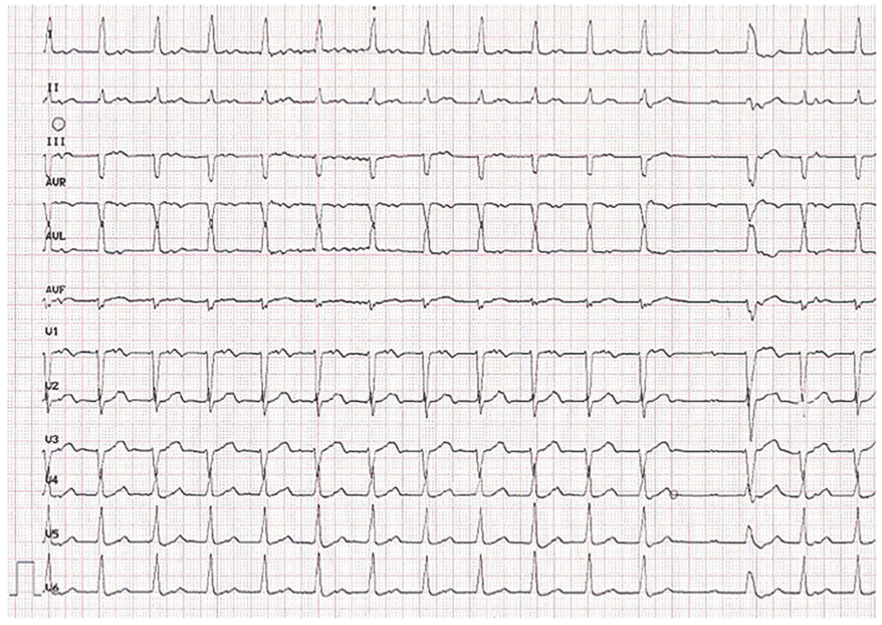Cardiovascmed 18 00034 g001