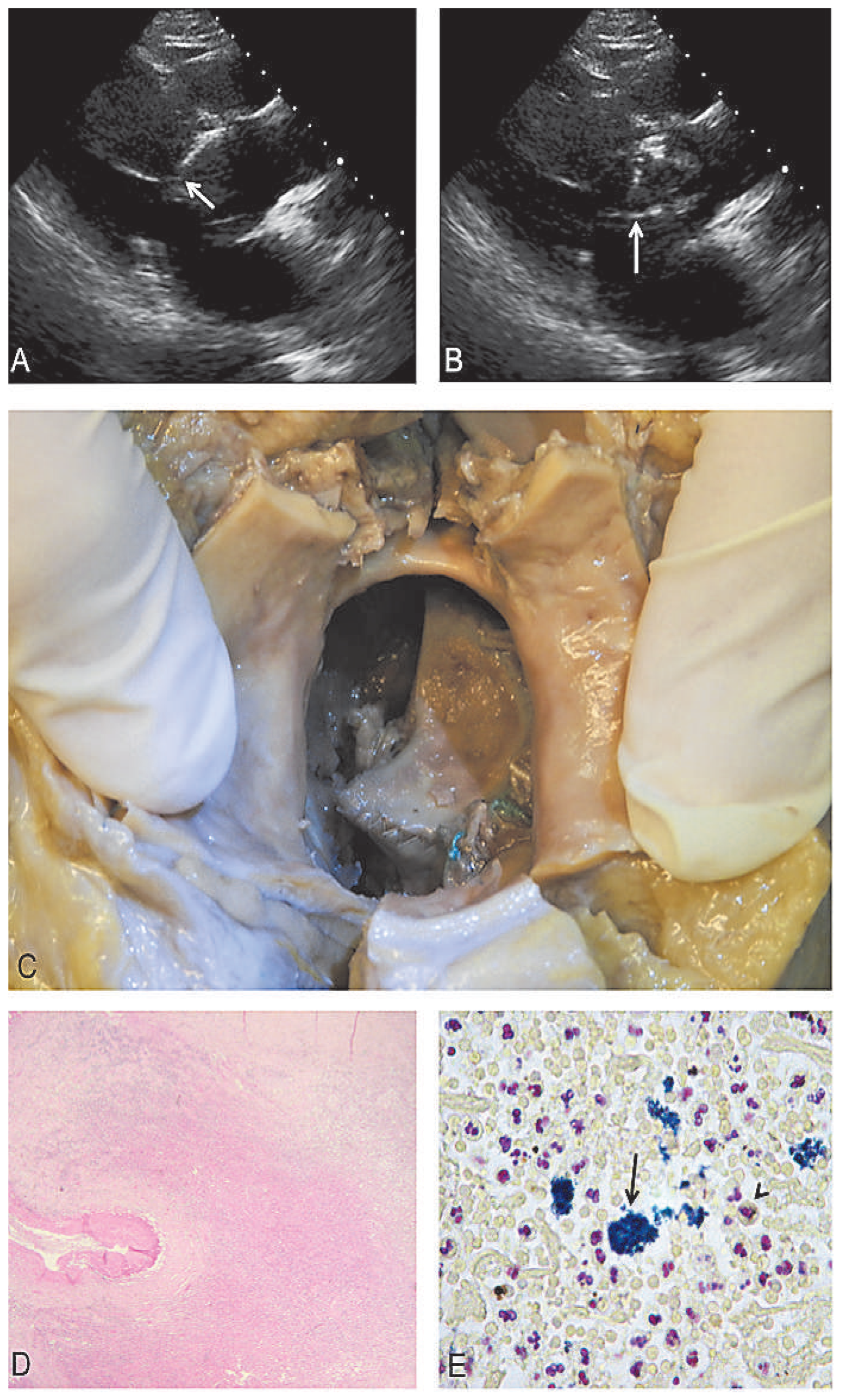 Cardiovascmed 18 00034 g002