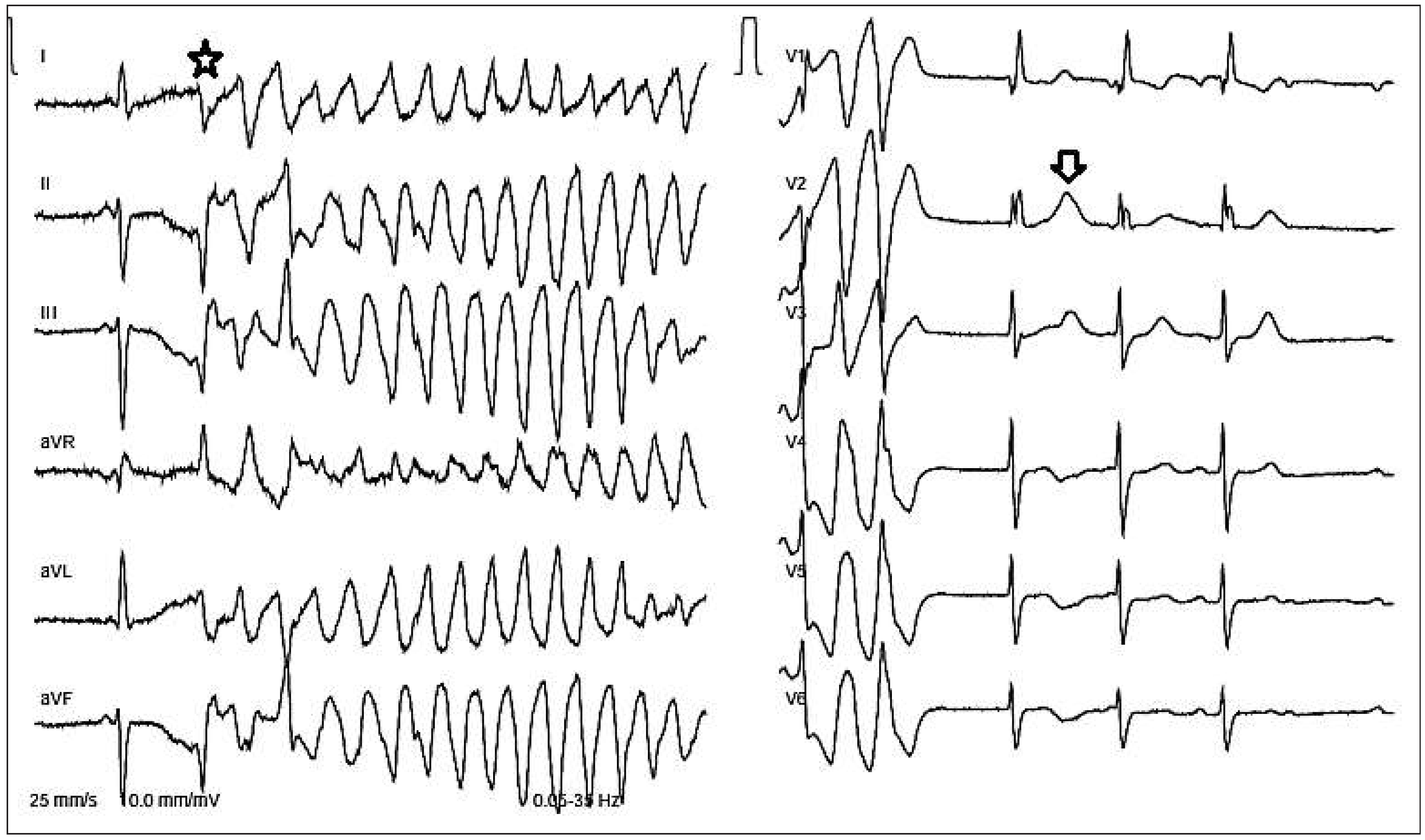 Cardiovascmed 18 00142 g001 Cardiovascmed 18 00142 g001