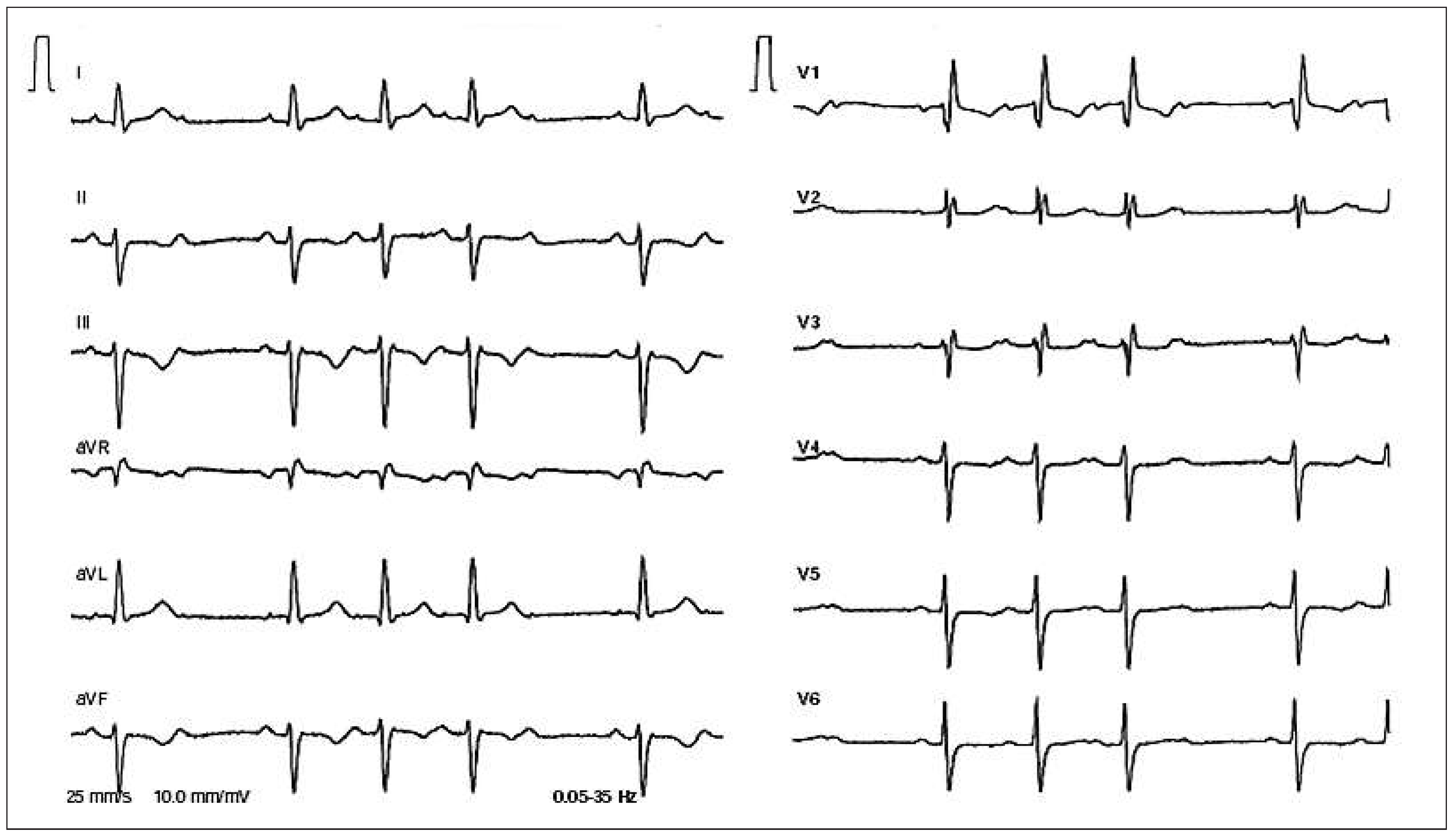 Cardiovascmed 18 00142 g002 Cardiovascmed 18 00142 g002