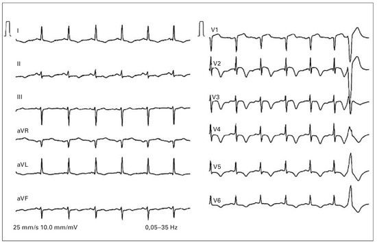 Cardiovascmed 18 00163 g002