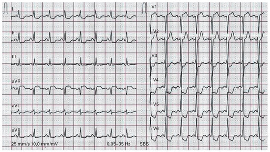 Cardiovascmed 18 00163 g004