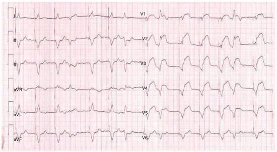 Cardiovascmed 18 00163 g005