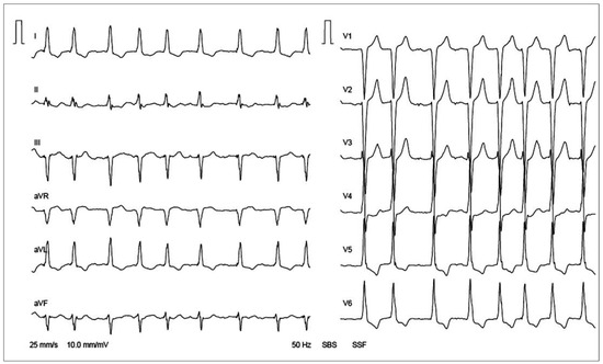 Cardiovascmed 18 00312 g002