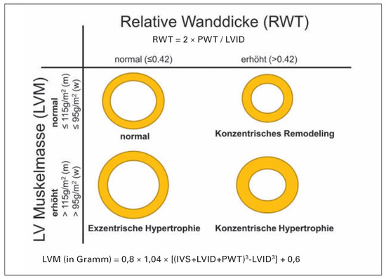 Cardiovascmed 18 00312 g003