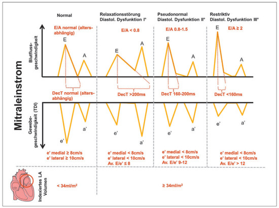 Cardiovascmed 18 00312 g004