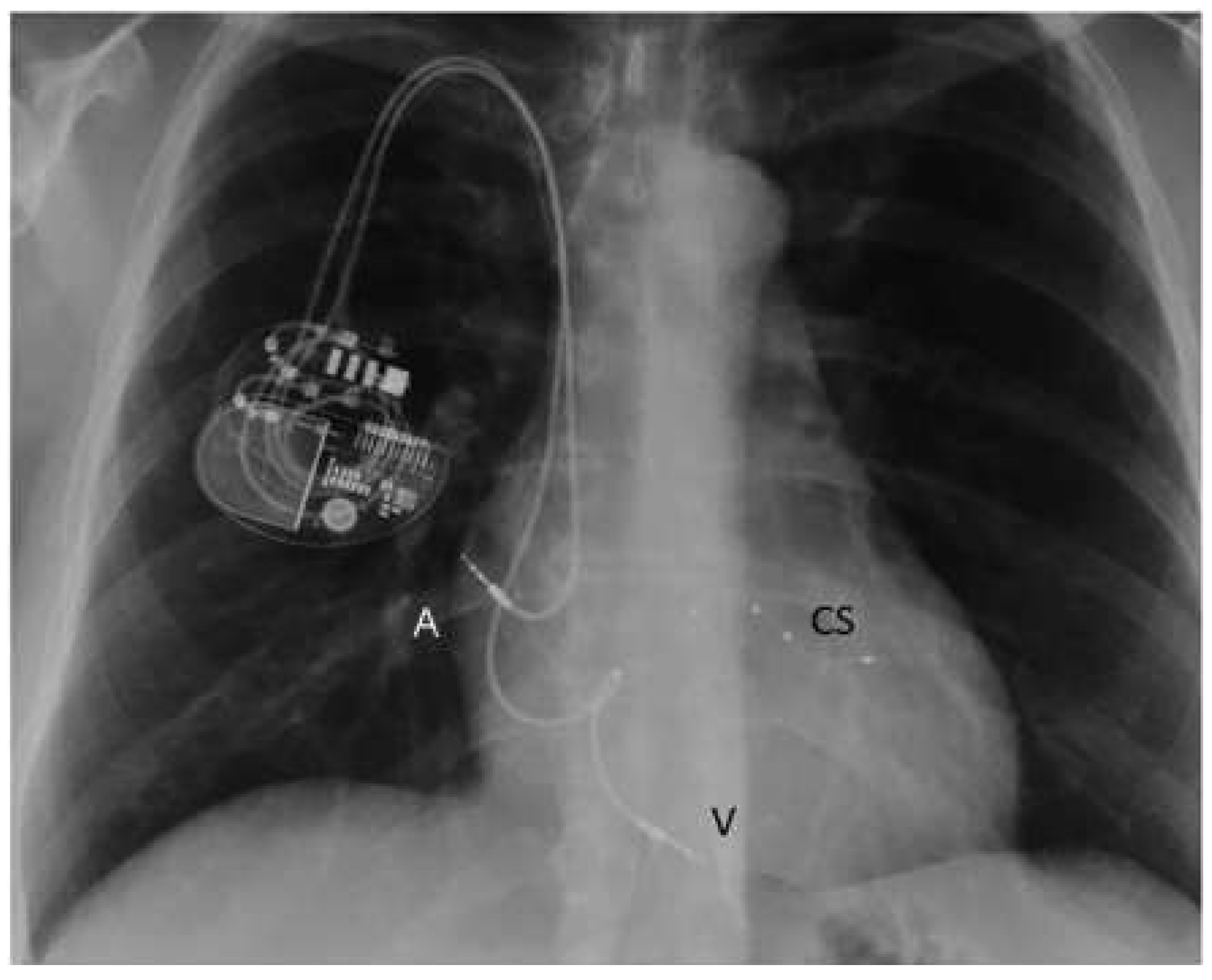 Cardiovascmed 19 00013 g001 Cardiovascmed 19 00013 g001