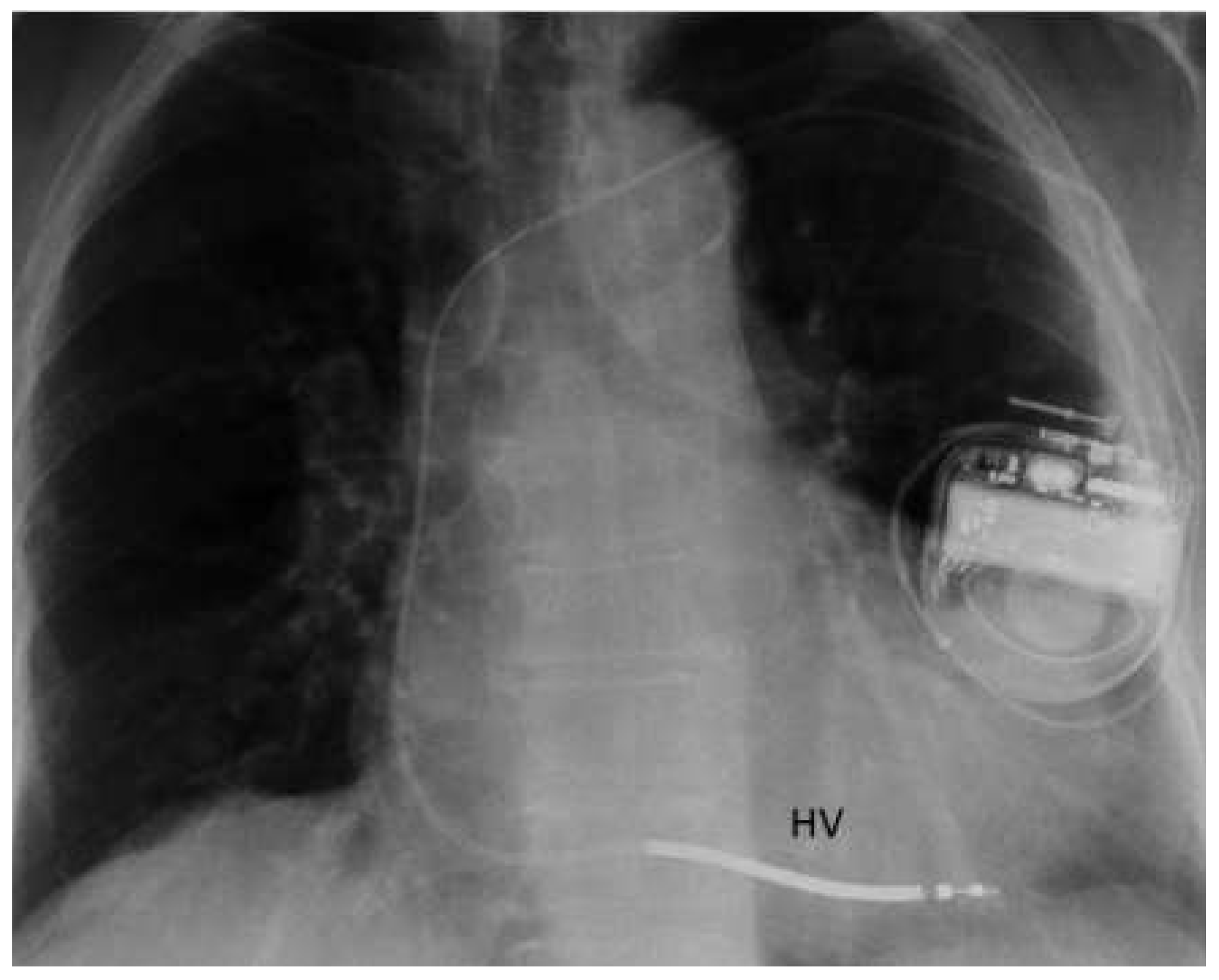 Cardiovascmed 19 00013 g002 Cardiovascmed 19 00013 g002