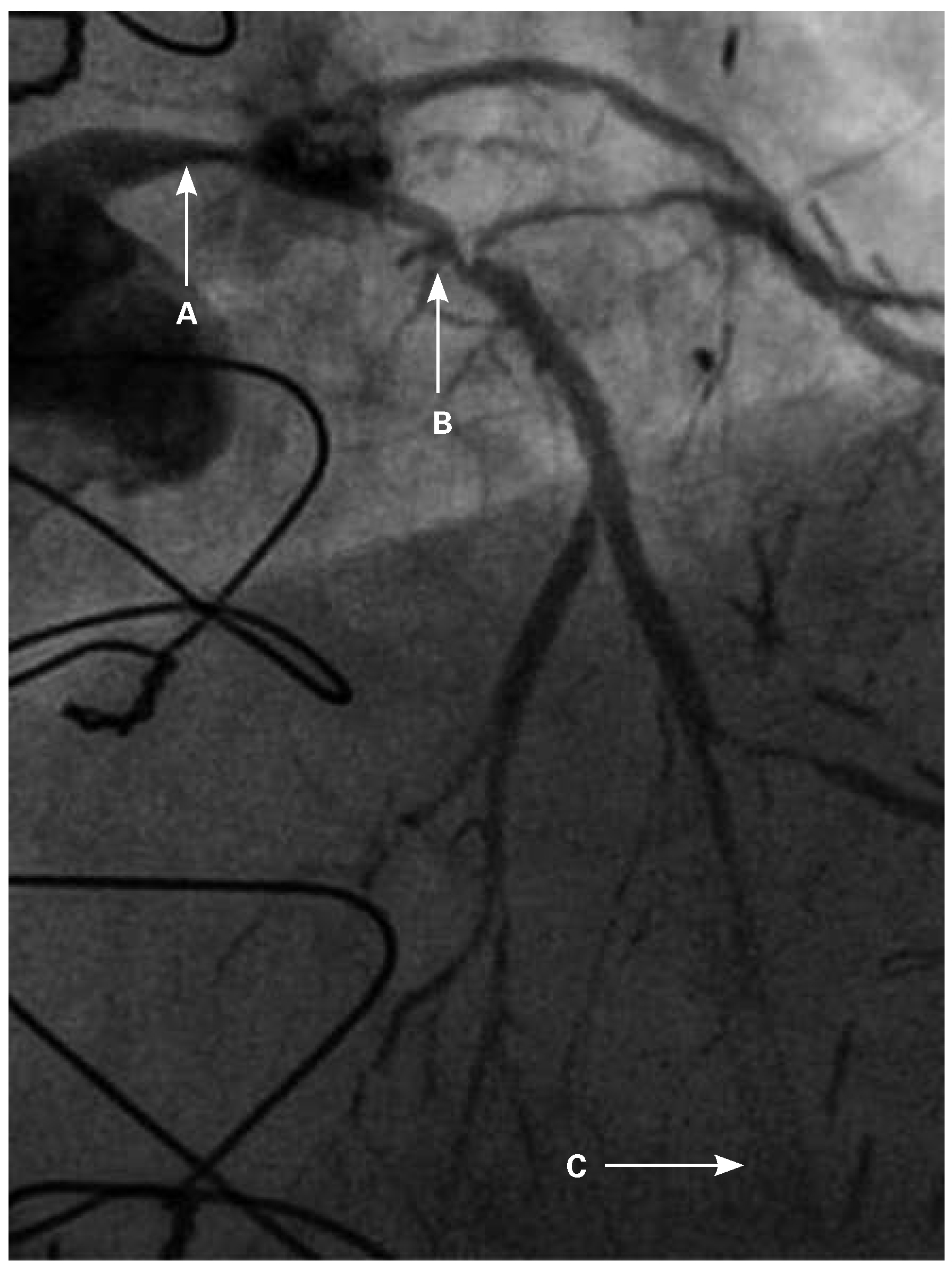 Cardiovascmed 19 00055 g001