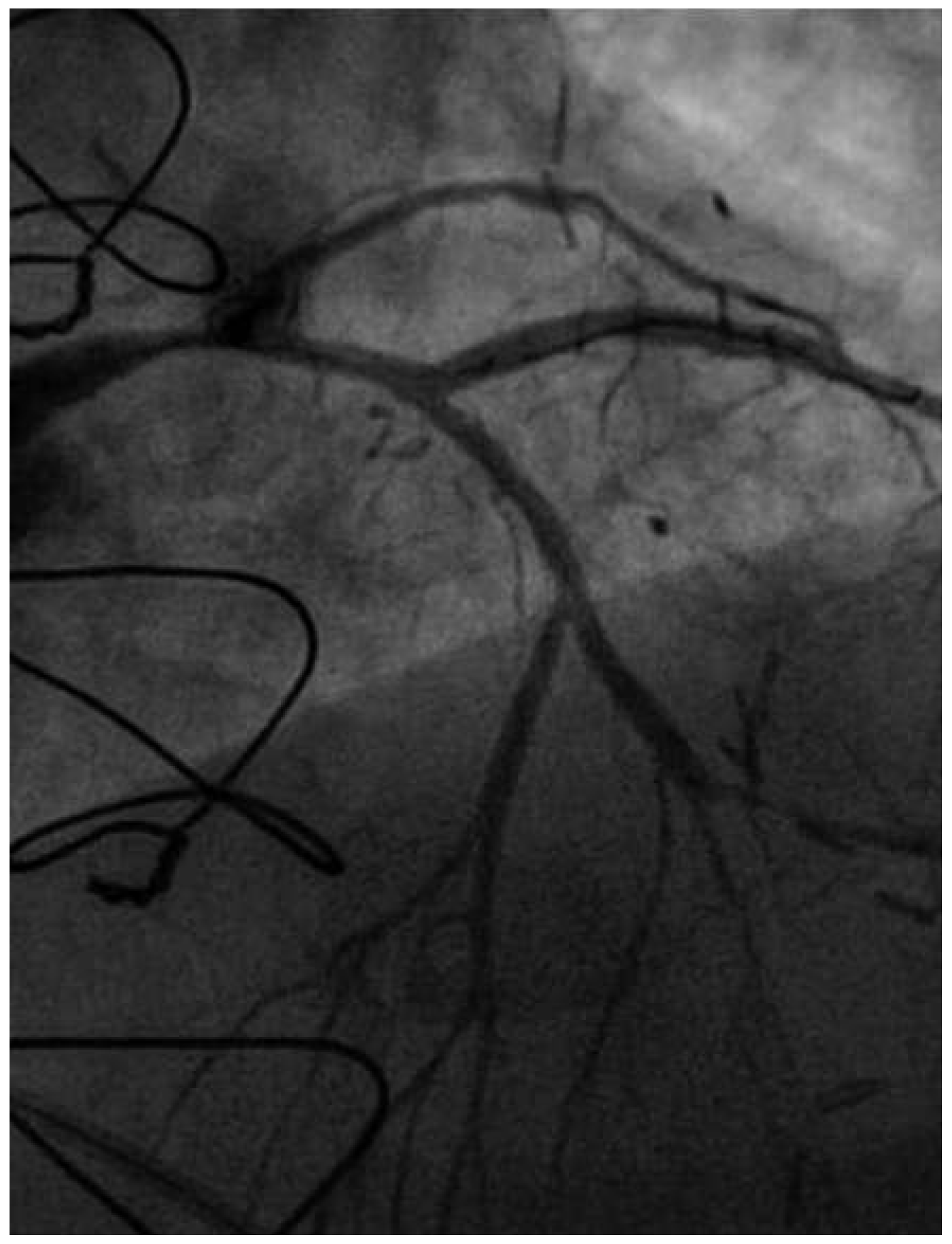 Cardiovascmed 19 00055 g003