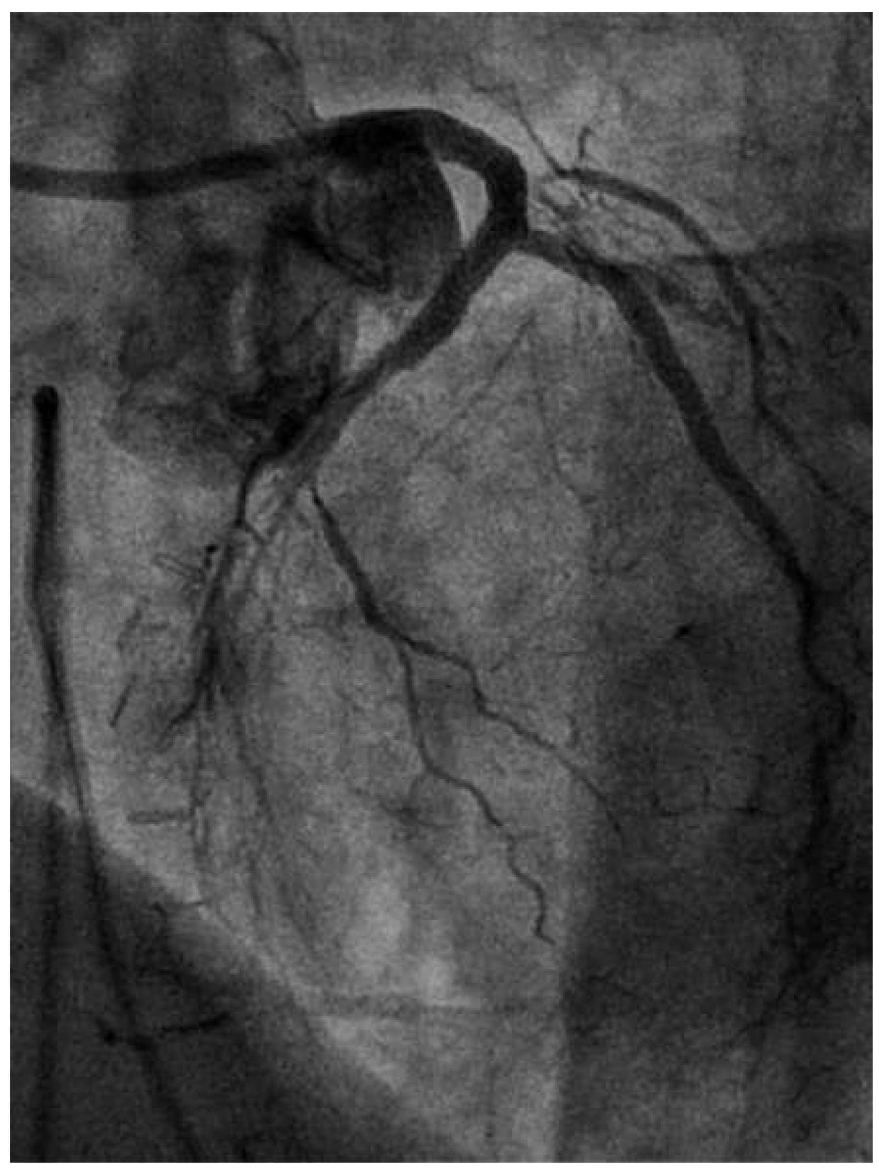 Cardiovascmed 19 00055 g004