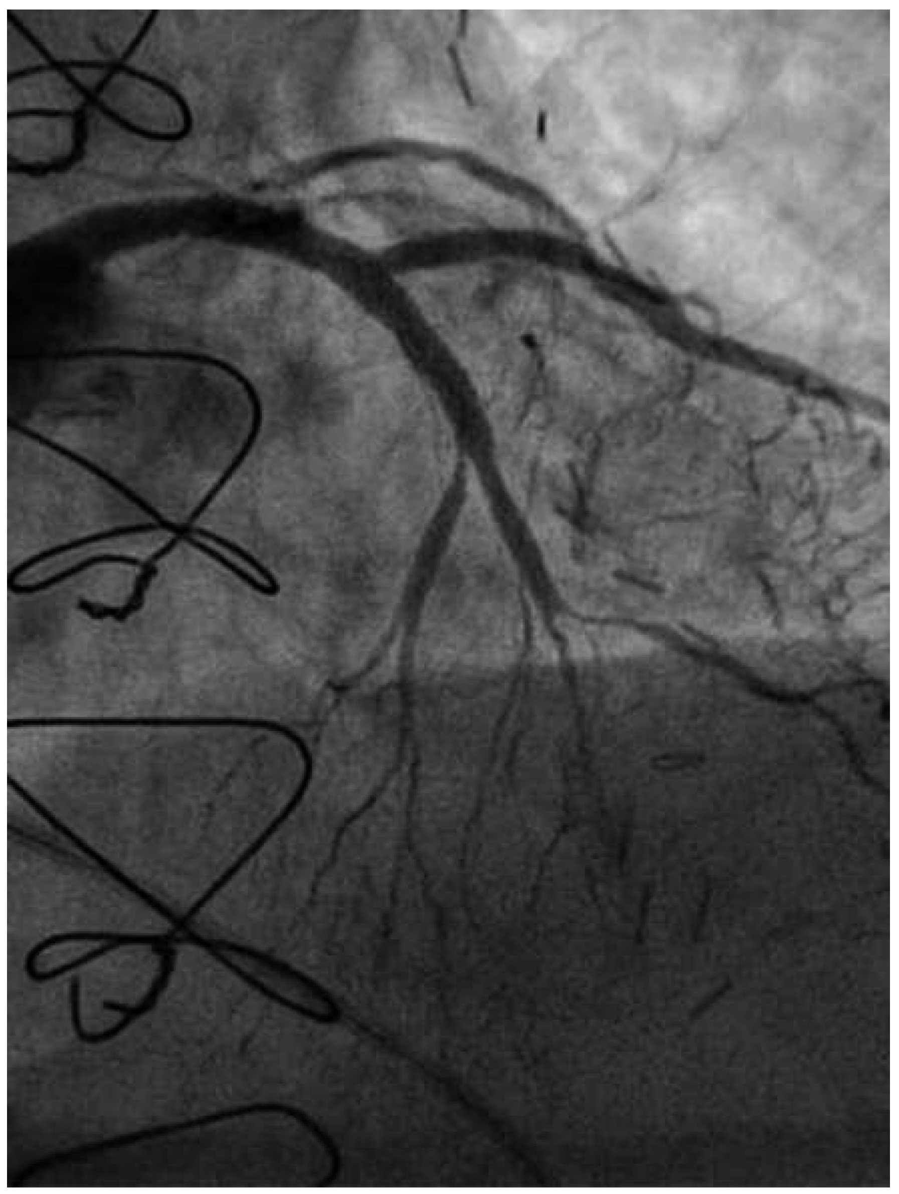Cardiovascmed 19 00055 g006