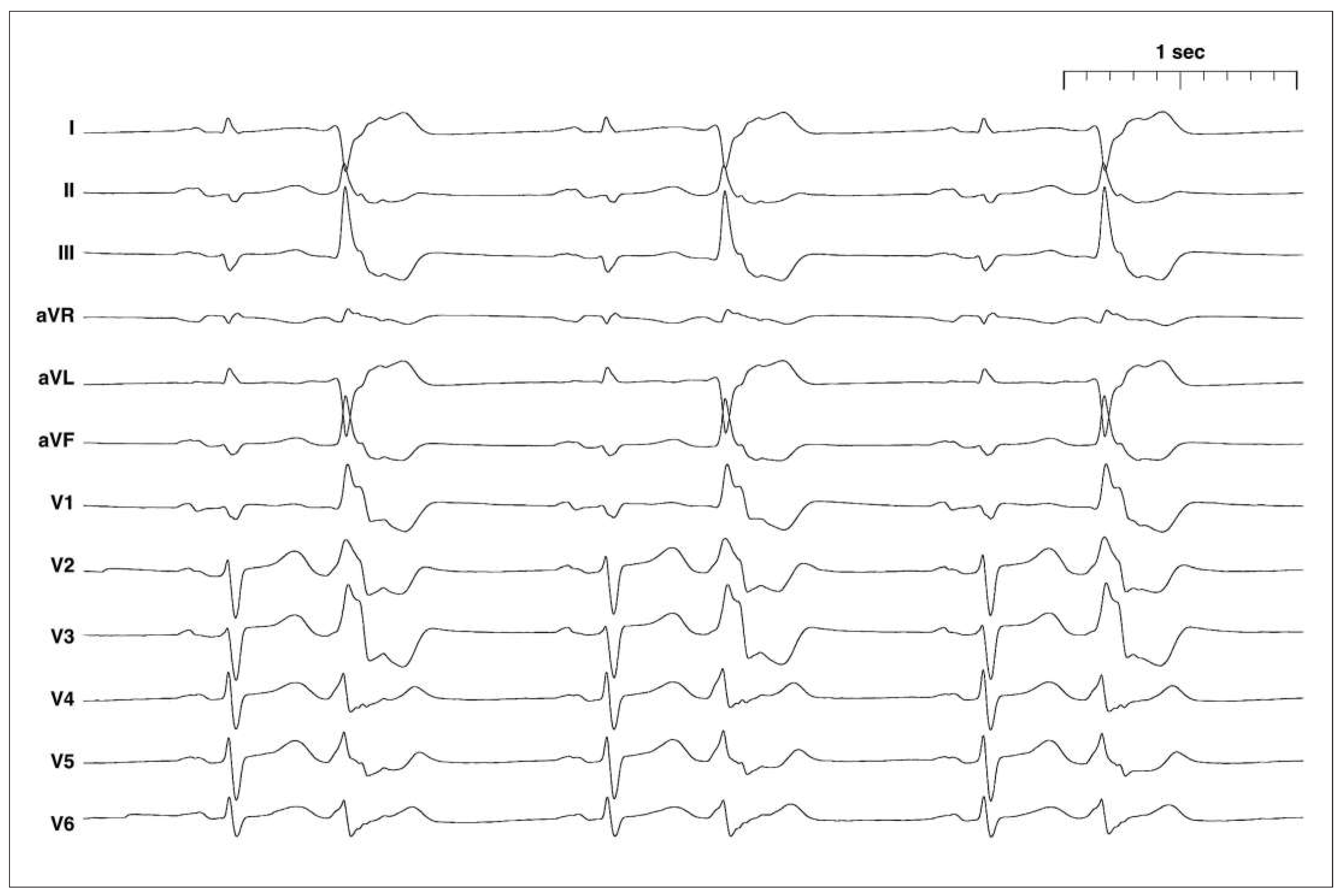 Cardiovascmed 19 00060 g001