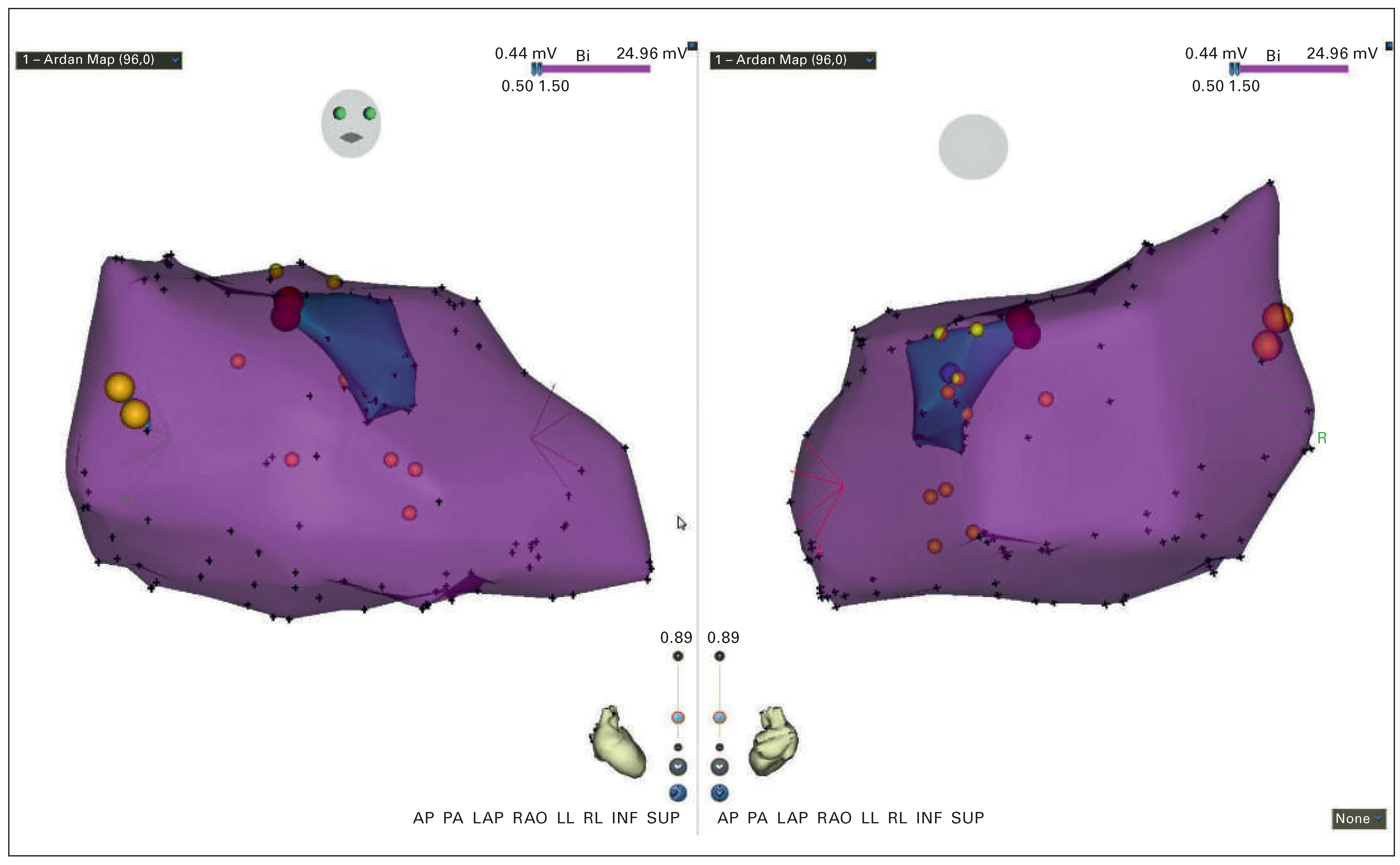 Cardiovascmed 19 00060 g002