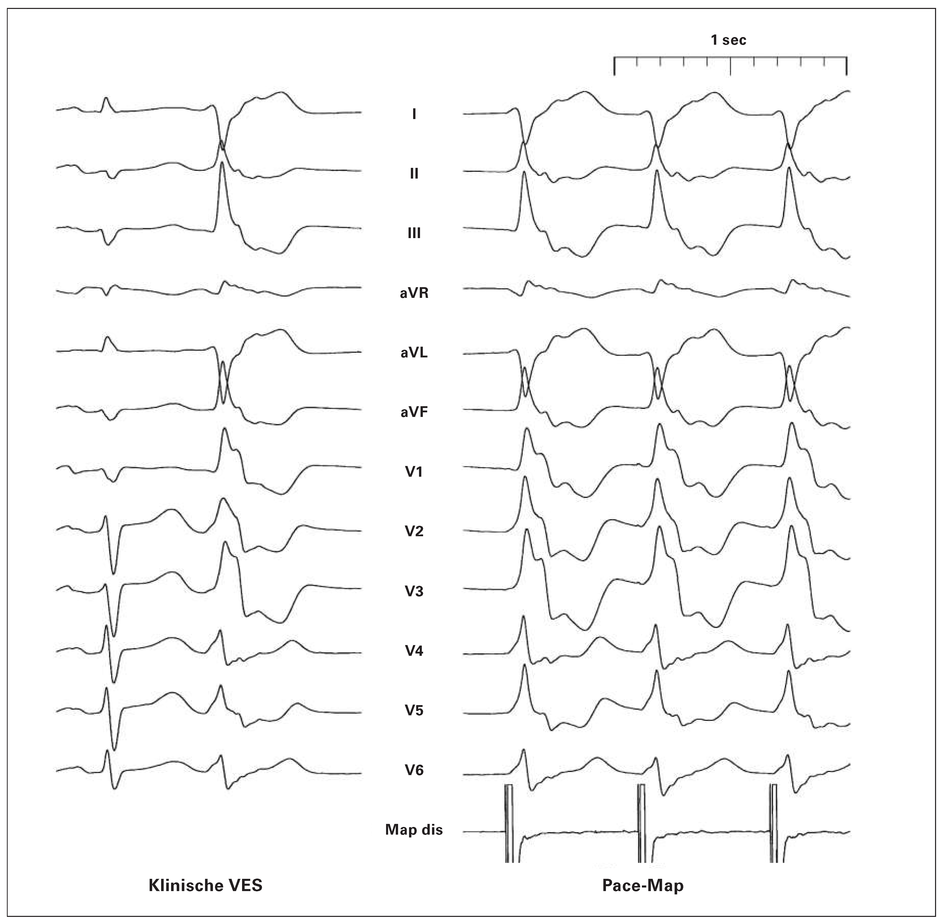 Cardiovascmed 19 00060 g003a