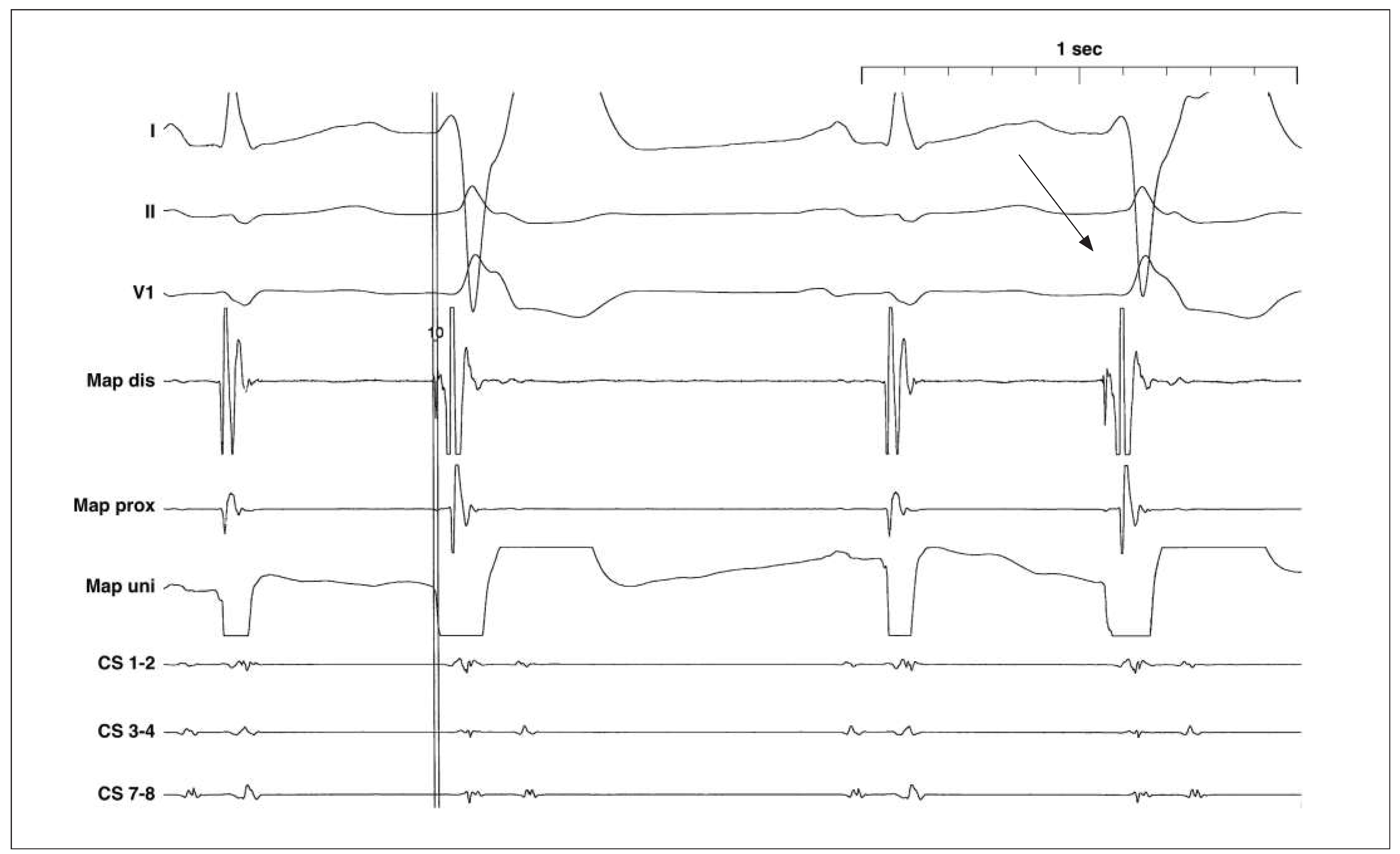Cardiovascmed 19 00060 g003b