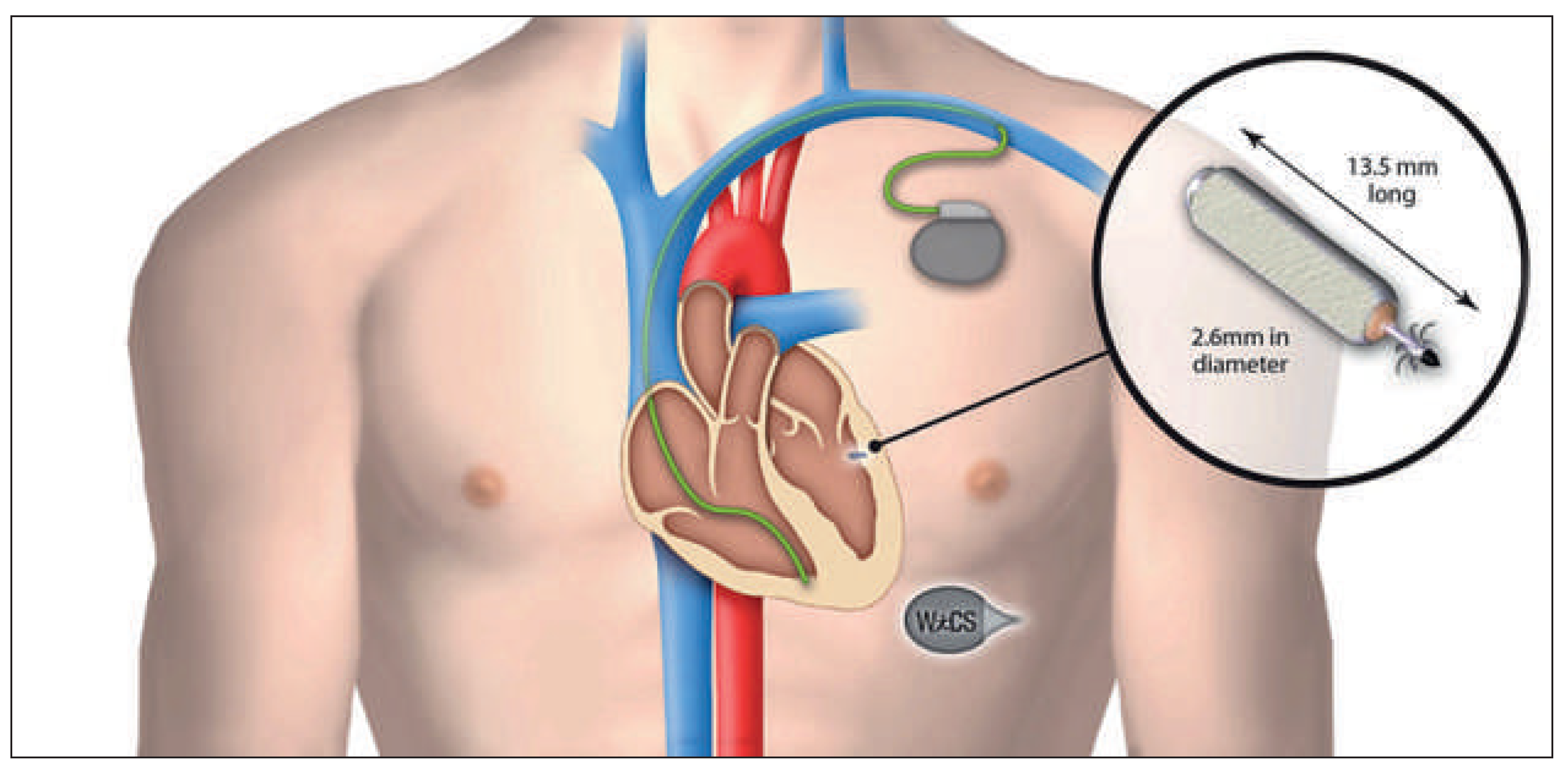 Cardiovascmed 19 00083 g002