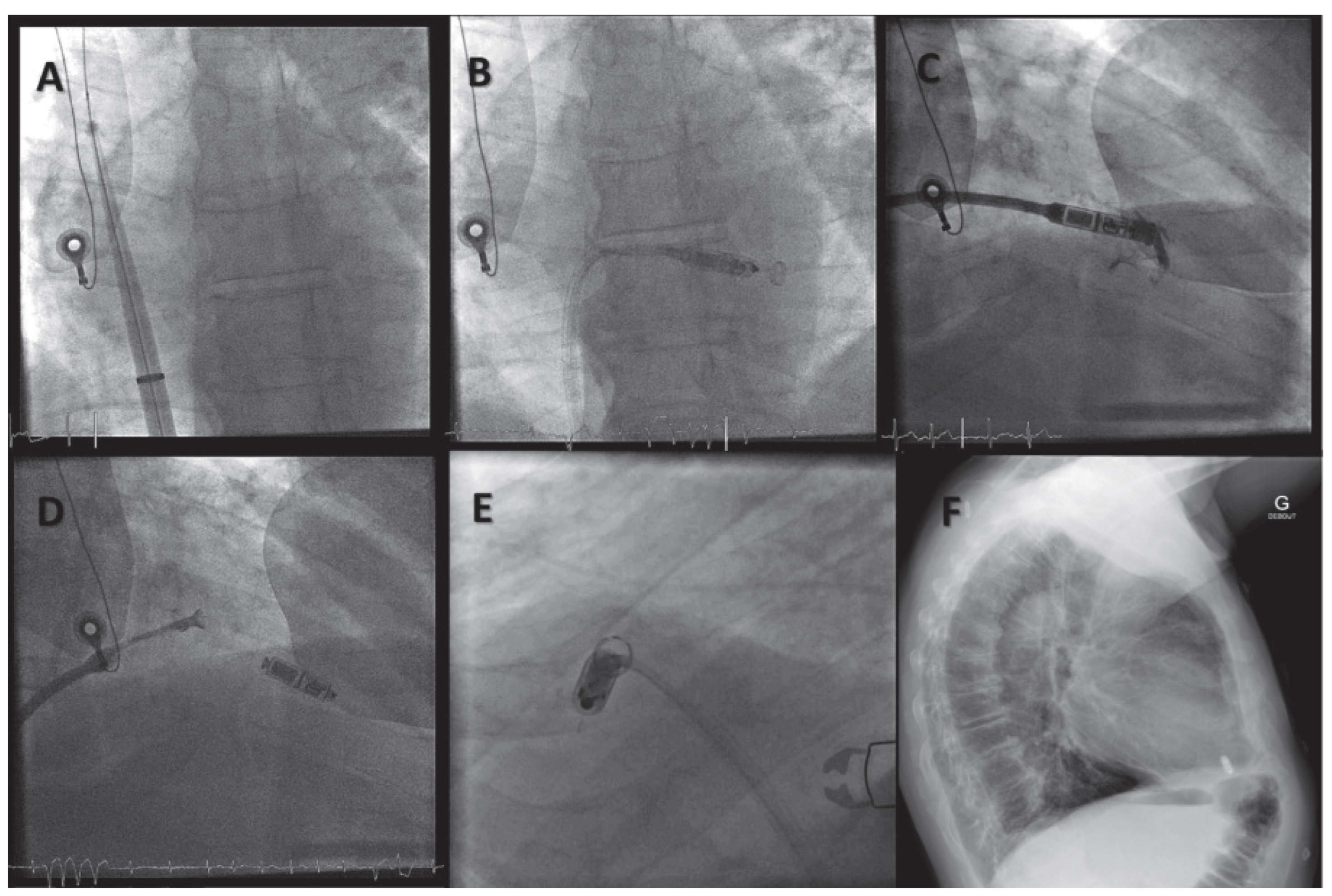 Cardiovascmed 19 00083 g003