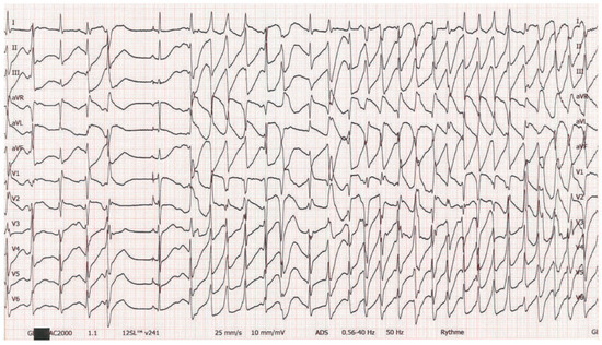 Cardiovascmed 19 00090 g001