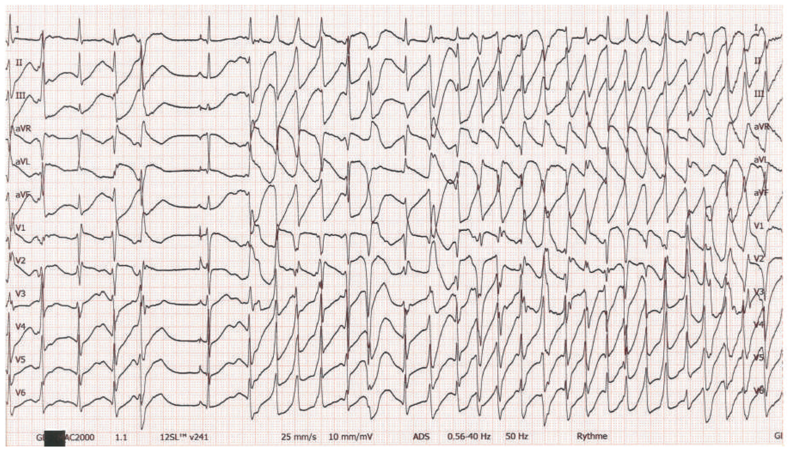 Cardiovascmed 19 00090 g001 Cardiovascmed 19 00090 g001