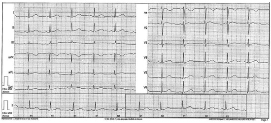 Cardiovascmed 19 00090 g002