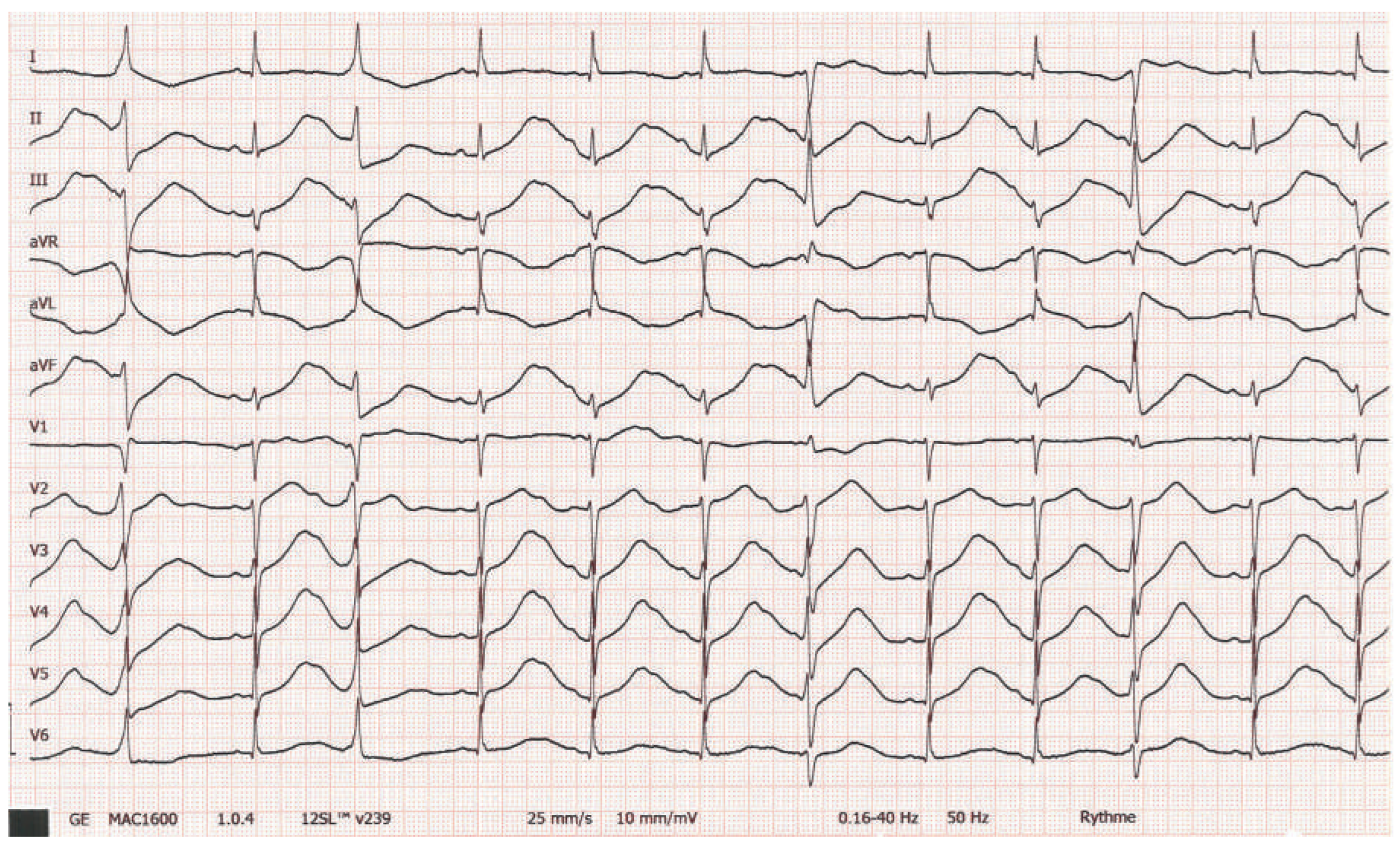 Cardiovascmed 19 00090 g003 Cardiovascmed 19 00090 g003