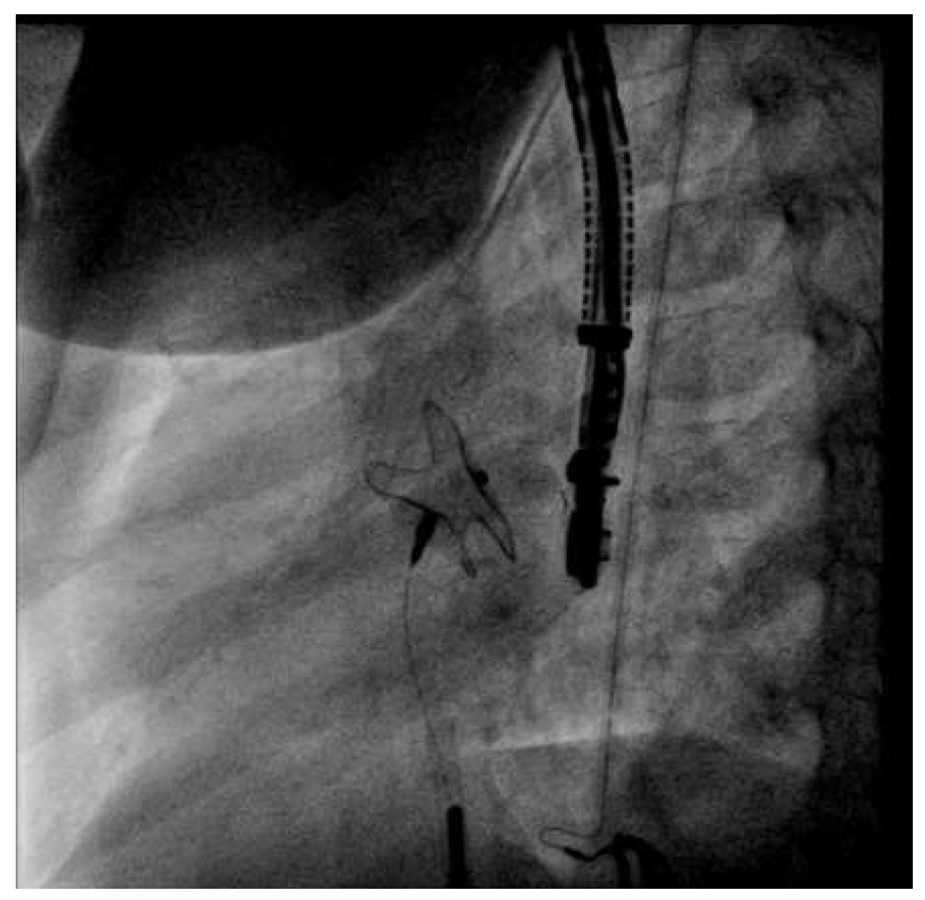 Cardiovascmed 19 00095 g001 Cardiovascmed 19 00095 g001