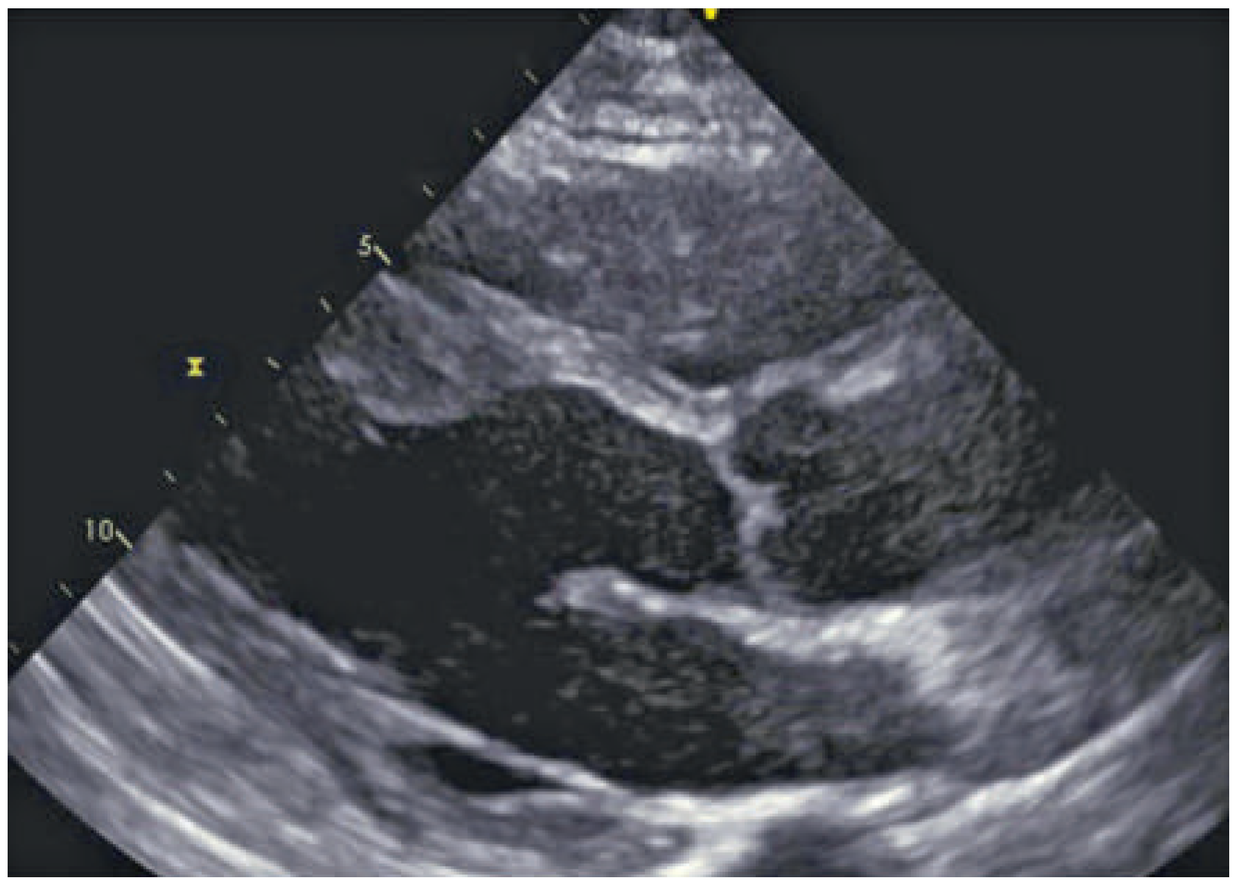 Cardiovascmed 19 00128 g001 Cardiovascmed 19 00128 g001