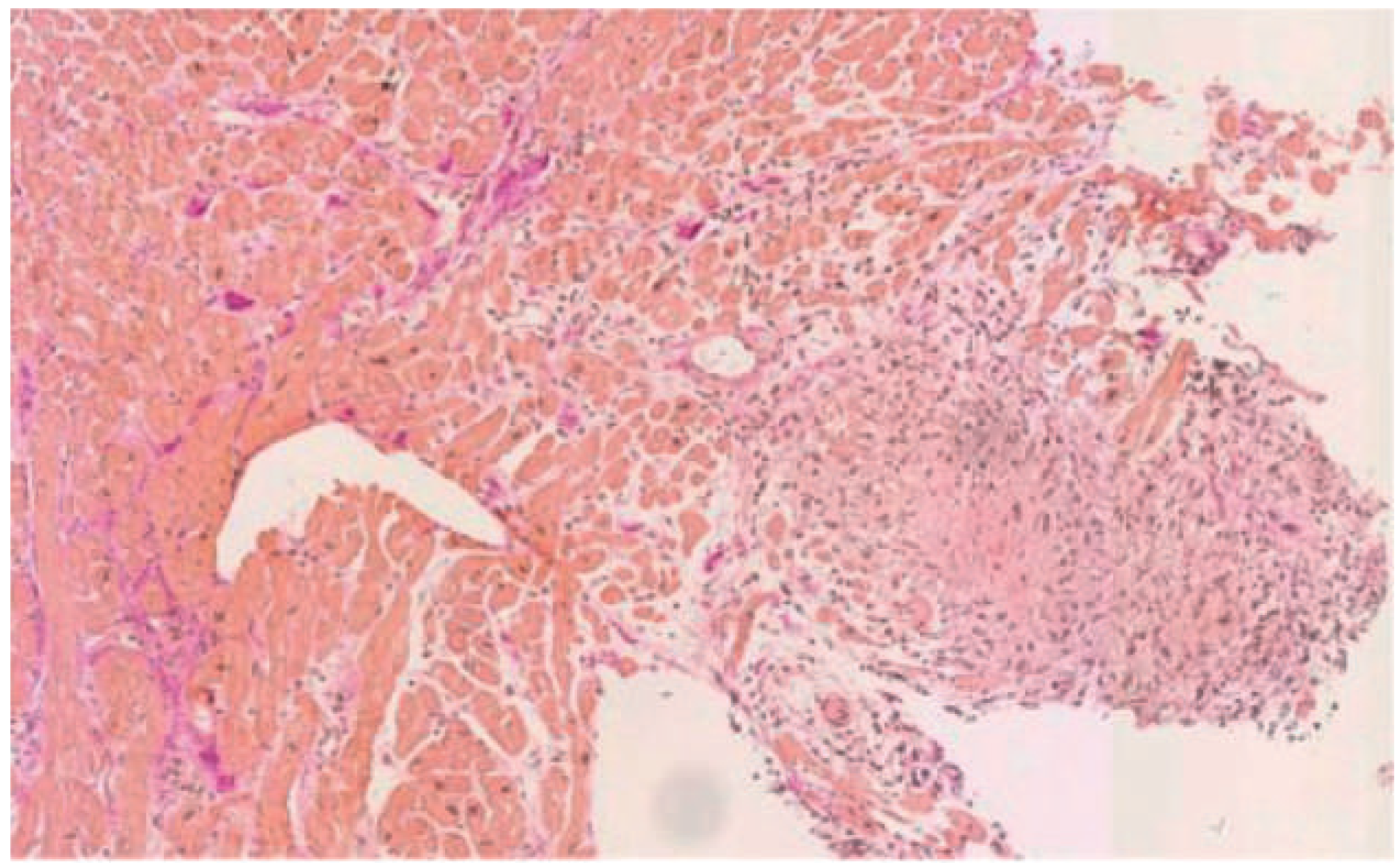 Cardiovascmed 19 00128 g002 Cardiovascmed 19 00128 g002