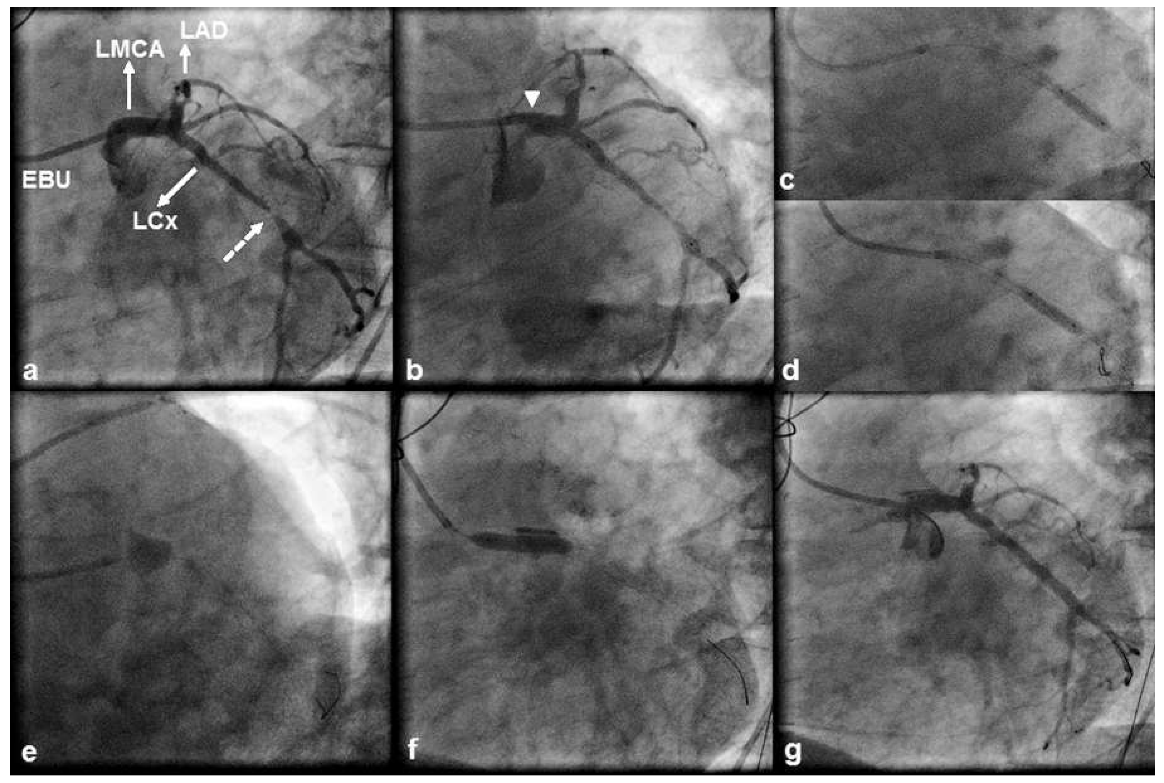 Cardiovascmed 19 00264 g001 Cardiovascmed 19 00264 g001