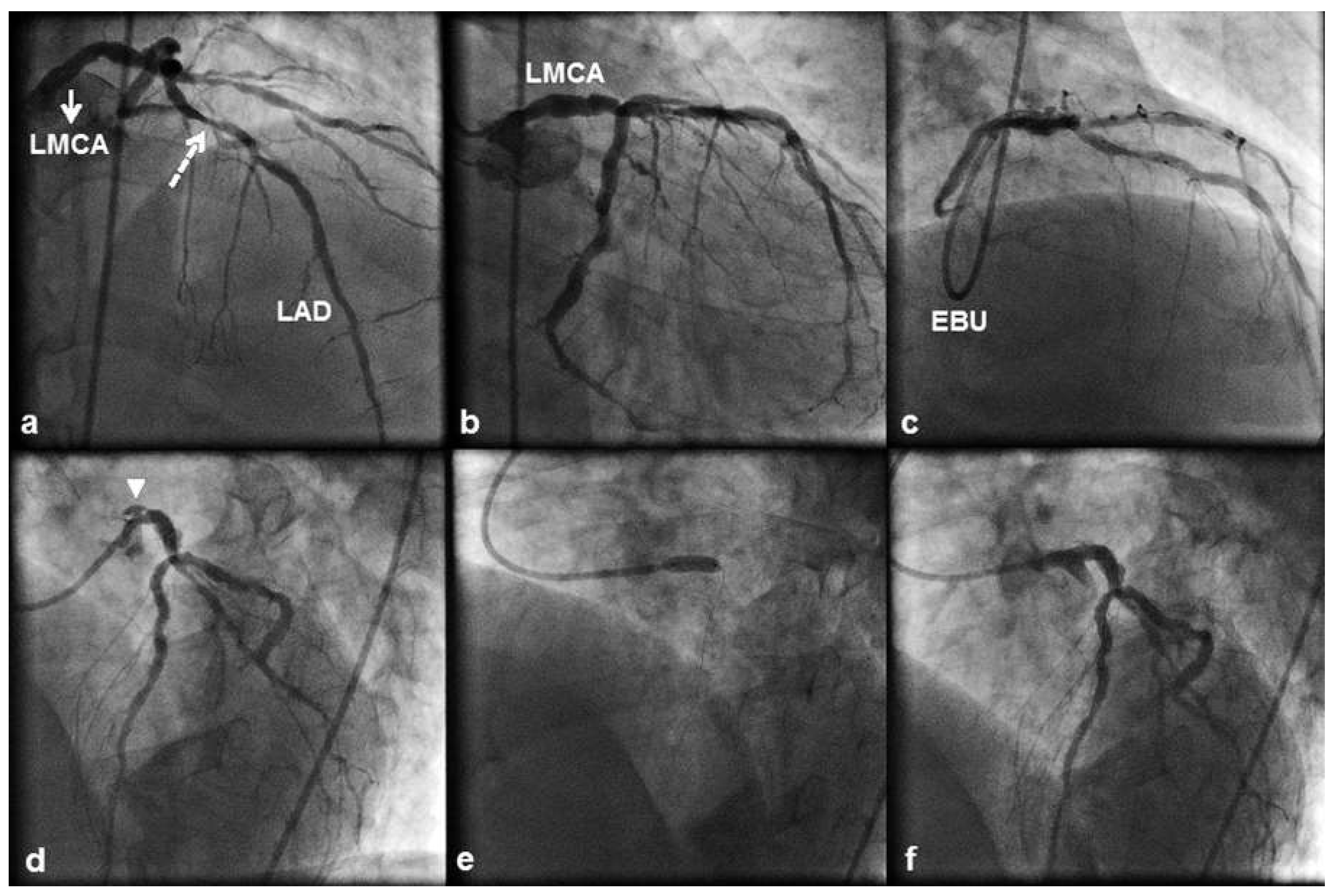Cardiovascmed 19 00264 g002 Cardiovascmed 19 00264 g002