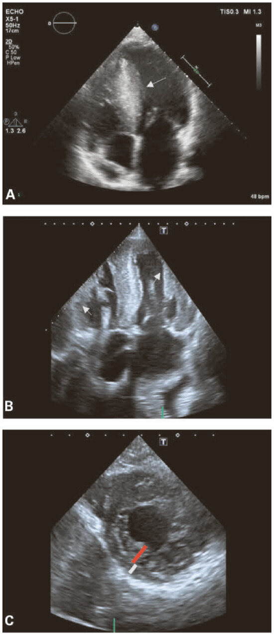 Cardiovascmed 20 00062 g004