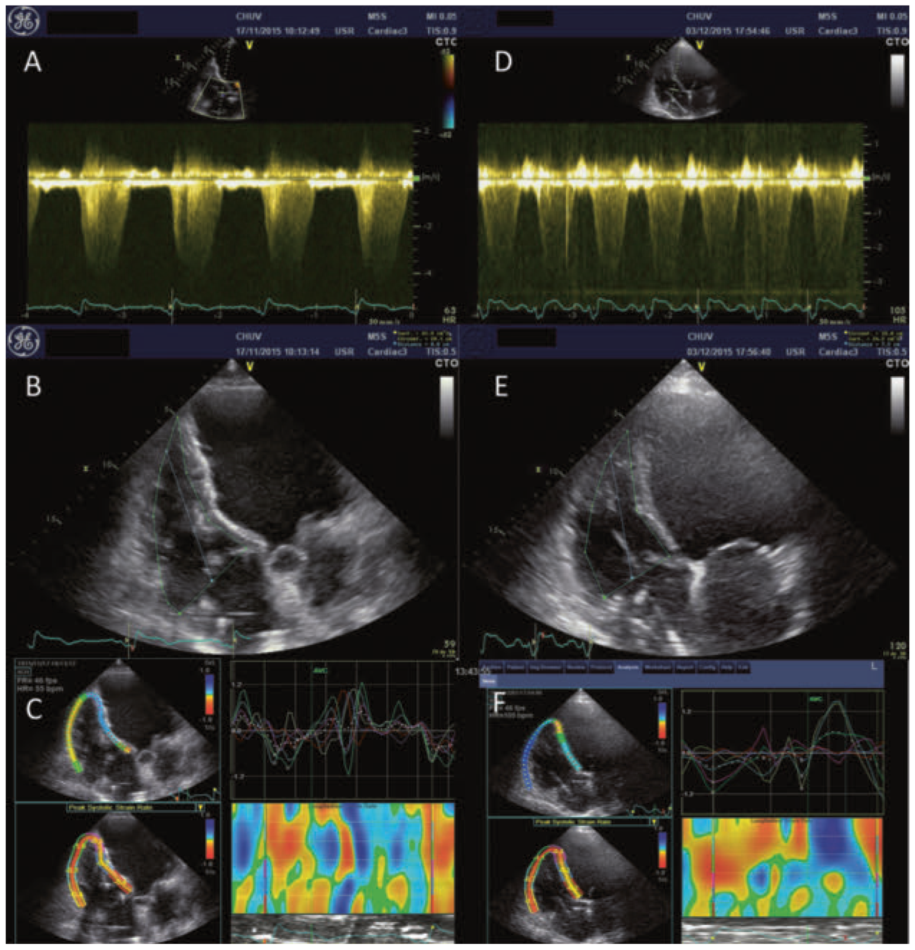 Cardiovascmed 20 00069 g001 Cardiovascmed 20 00069 g001